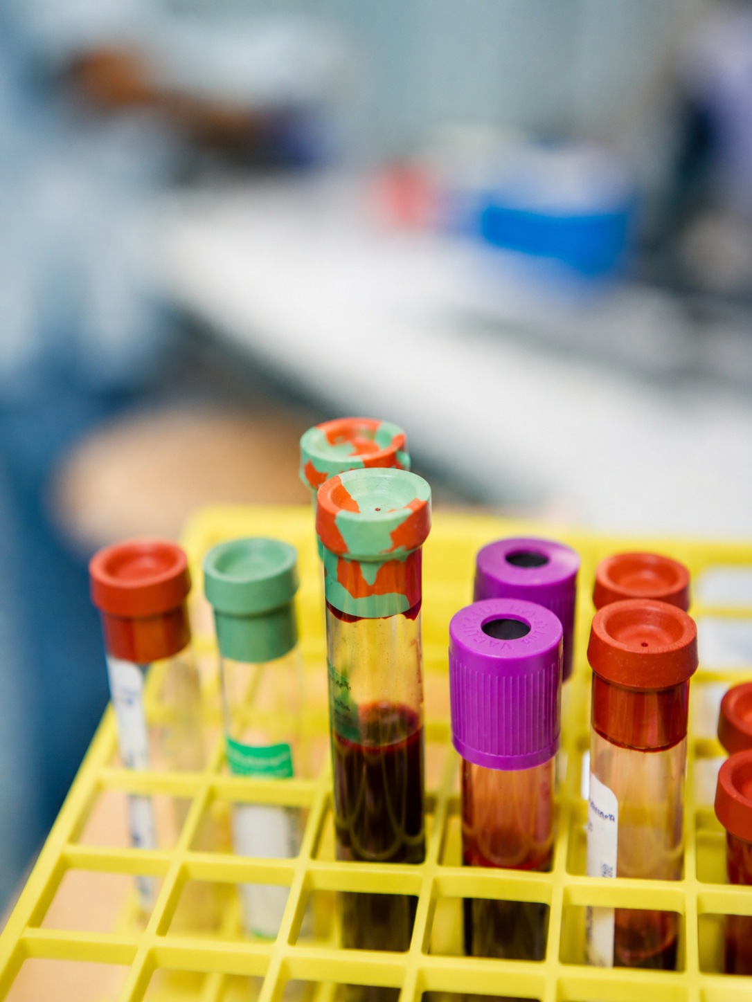 ctDNA and ctRNA in lung cancer: what can liquid biopsy tell us?