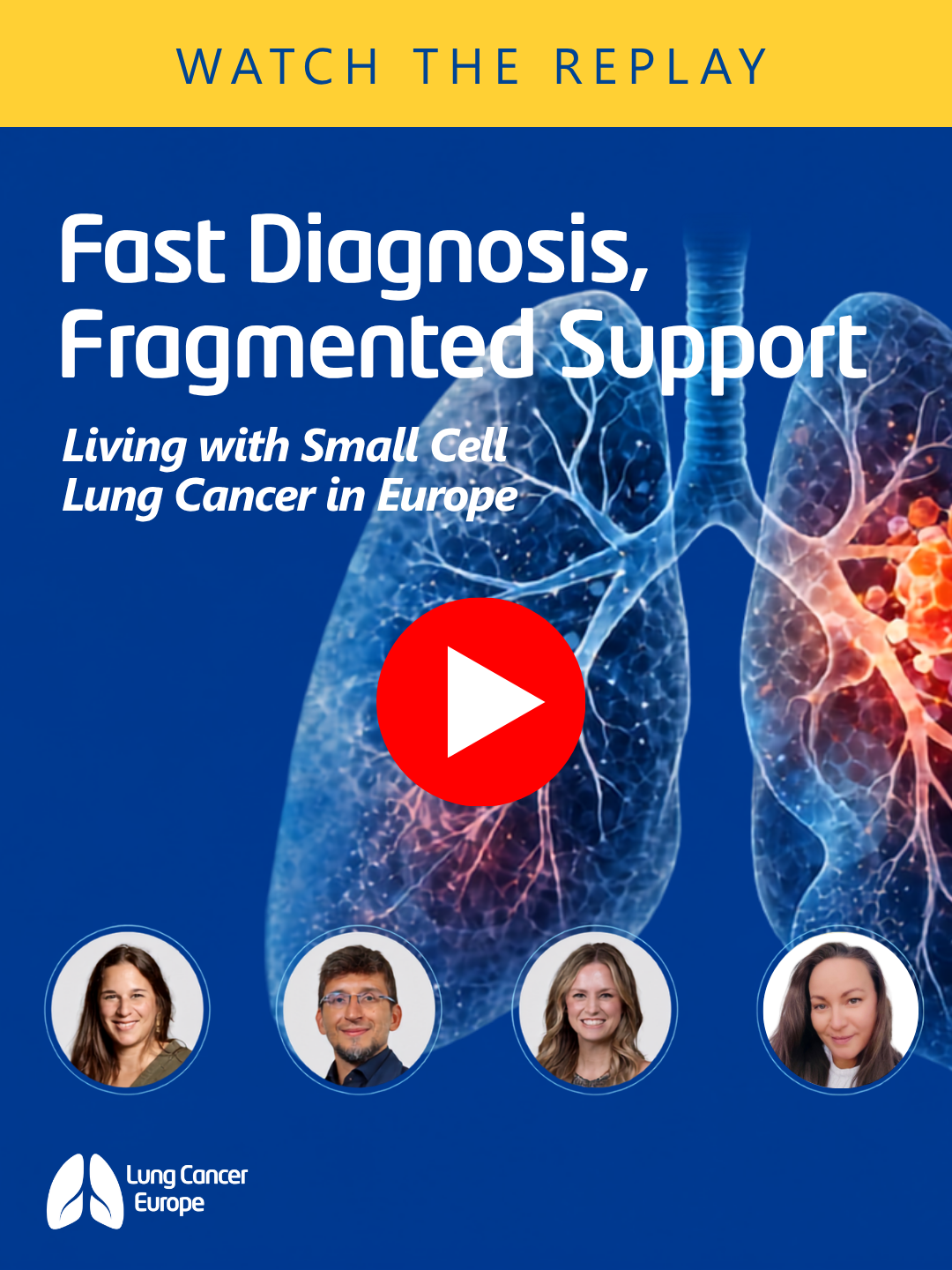 Fast diagnosis, fragmented support: watch our small cell lung cancer webinar