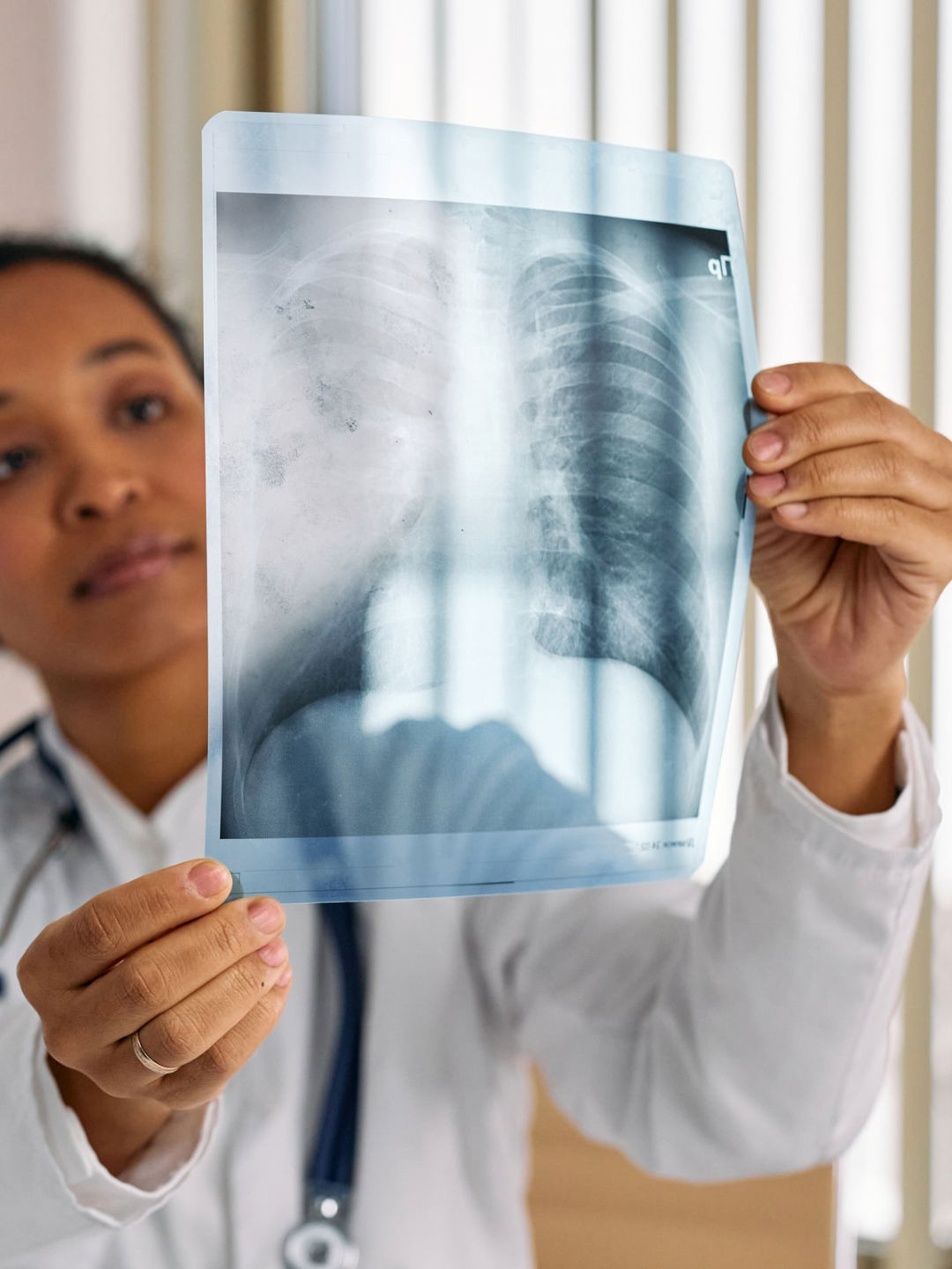 A doctor reviews a chest X-ray, examining lung imaging in a clinical setting.