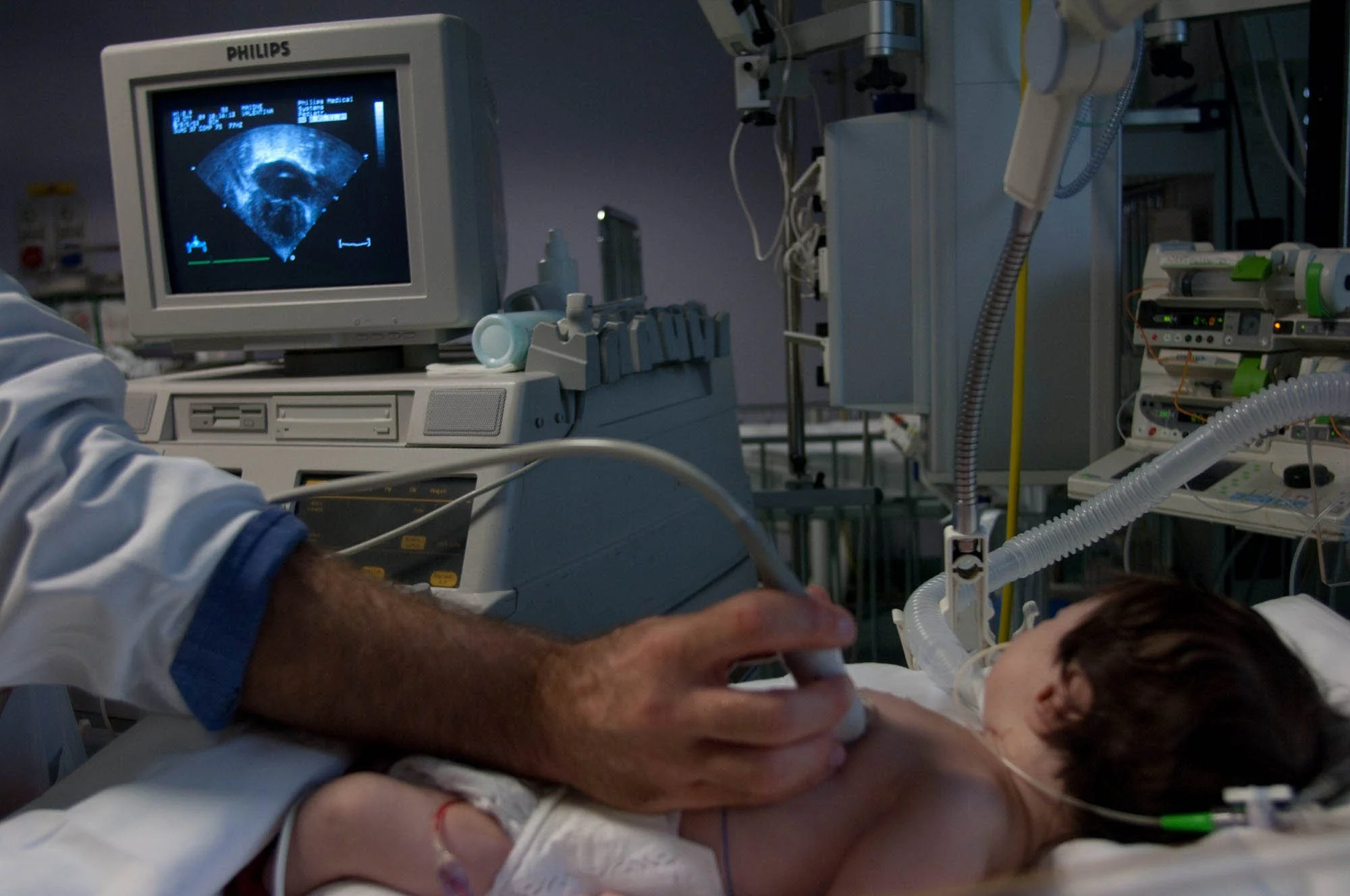Terapia_Intensiva_CardioChirurgia_Infantile_Ecocardio007.jpg