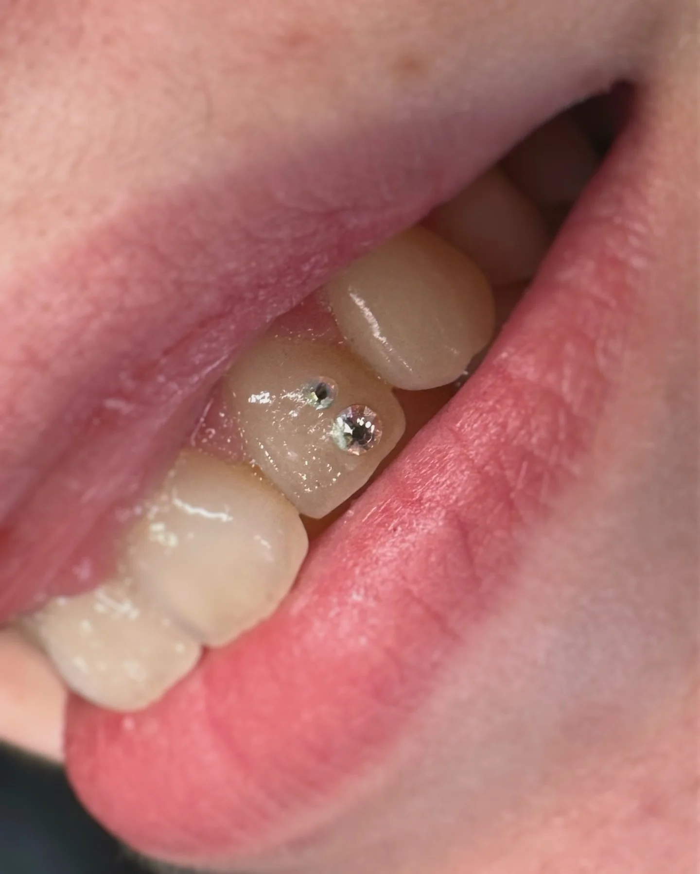 Top gem was added on by me, bottom gem not by me

Have an existing gem and want more? Let&rsquo;s do it! 

Done at @le.116.tattooclub during my guest spot 

Tooth gems, bijoux dentaires, strass dentaire, Swarovski, Montreal, Sherbrooke