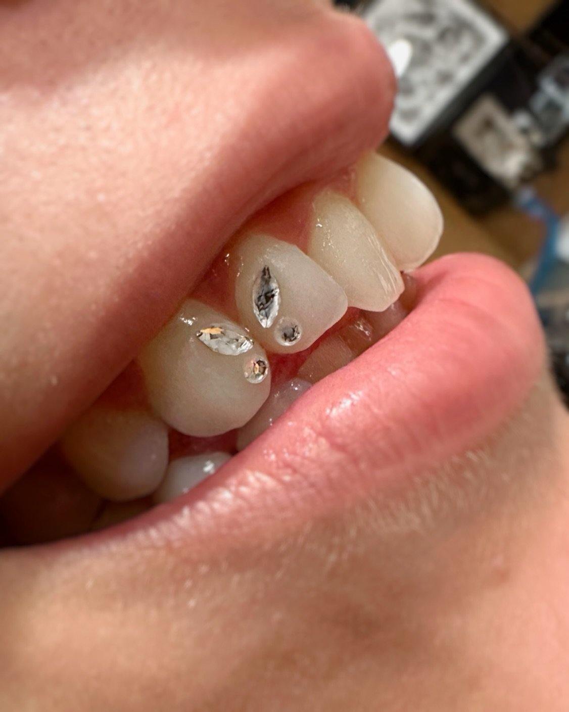 Butterfly tooth gems are always a hit 🦋🦋🦋

Done at @le.116.tattooclub during my guest spot