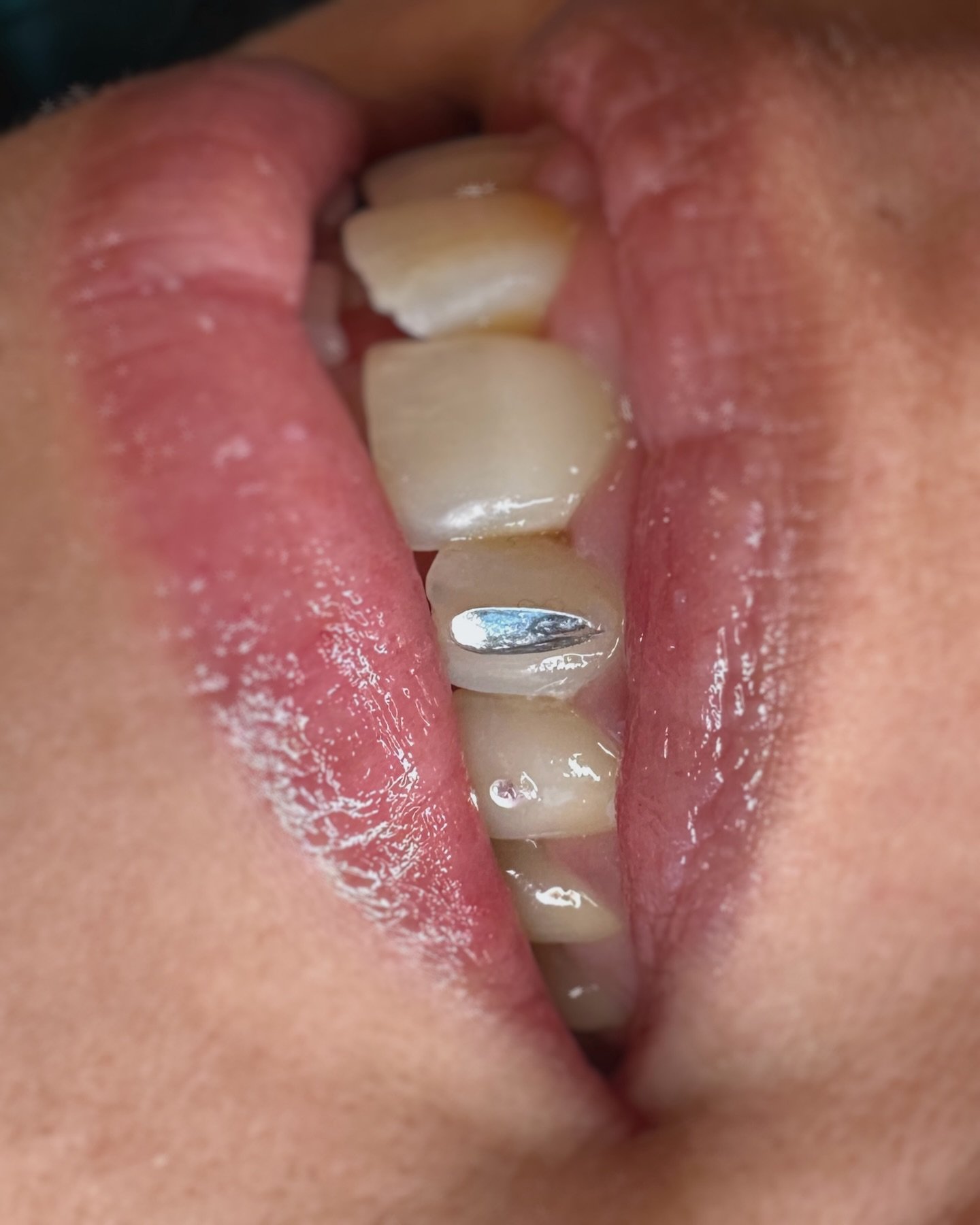 Teardrop on the incisor and tiny gem on the canine on my dear friend @bb.hurricane 

We also did some cute stuff on the other side that I forgot to take a picture of that looked like this ❖ but with round gems and you&rsquo;ll just have to trust me t