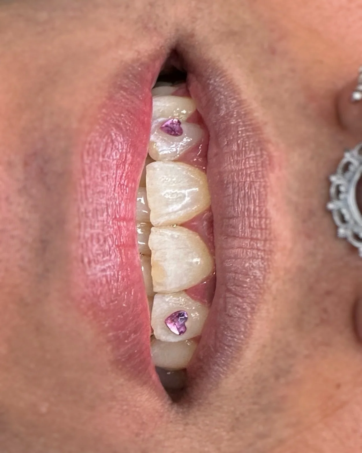 Double pink heart incisors for Santhi, I&rsquo;m obsessed 😍

More hearts and more pink please!! 

Done at @le.116.tattooclub during my guest spot

Booking for March and april now, link in bio 💖