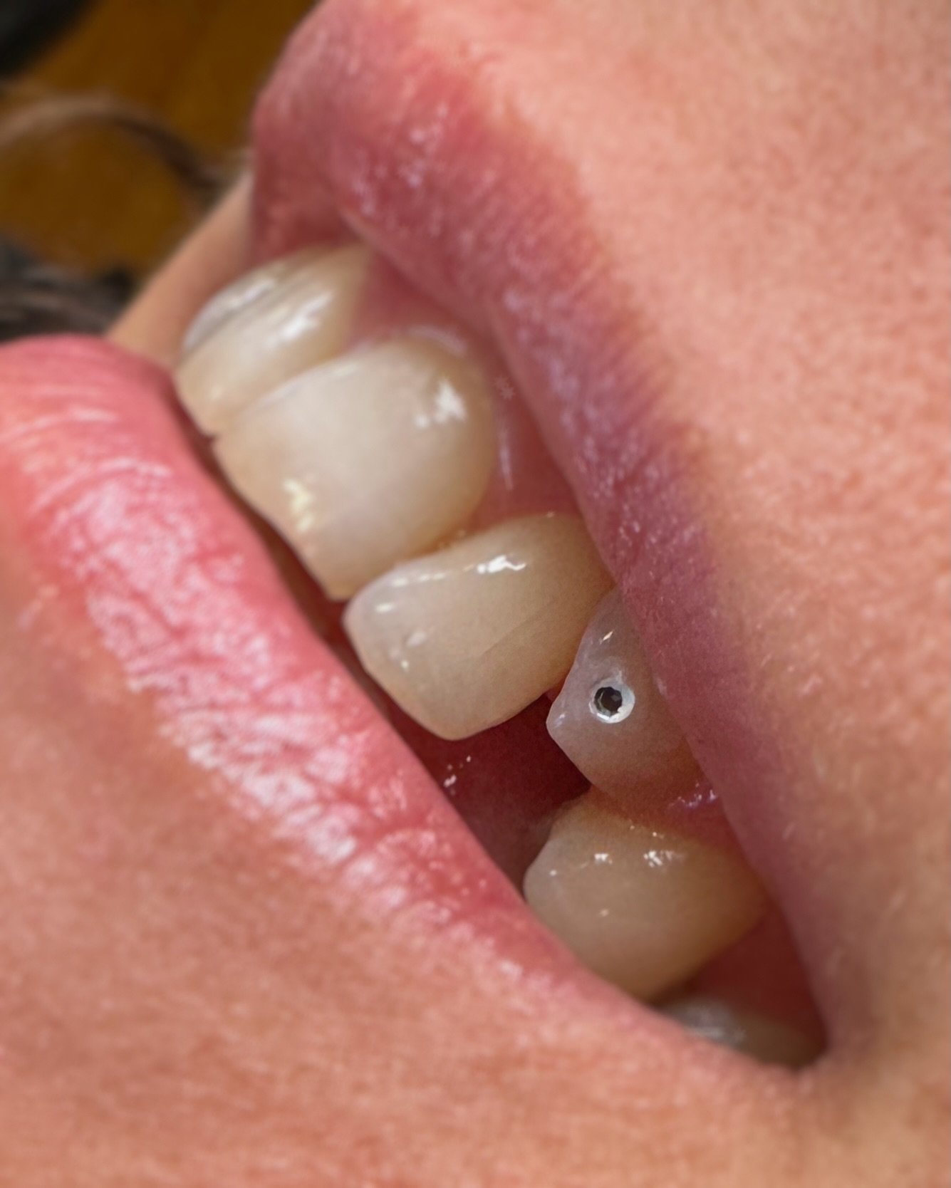 Little accent gem on my client&rsquo;s canine to add a little sparkle to her smile ❇️

Done at @le.116.tattooclub during my guest spot 

Tooth gems, bijoux dentaires, strass dentaire, montreal, sherbrooke