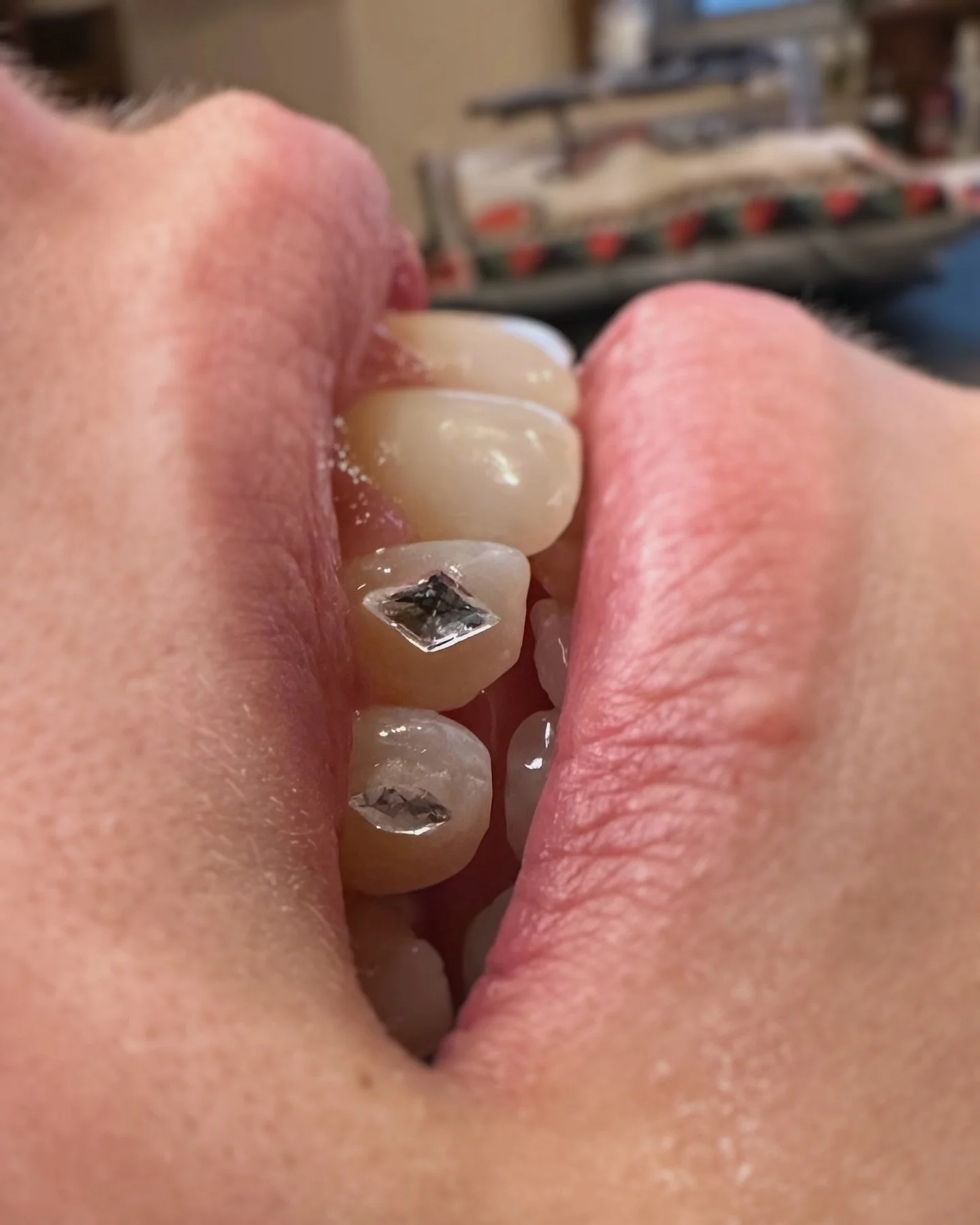 Diamond + marquise combos 🪞💠

Done at @le.116.tattooclub during my guest spot

Tooth gems, bijoux dentaires, strass dentaire, Swarovski, montreal, Sherbrooke