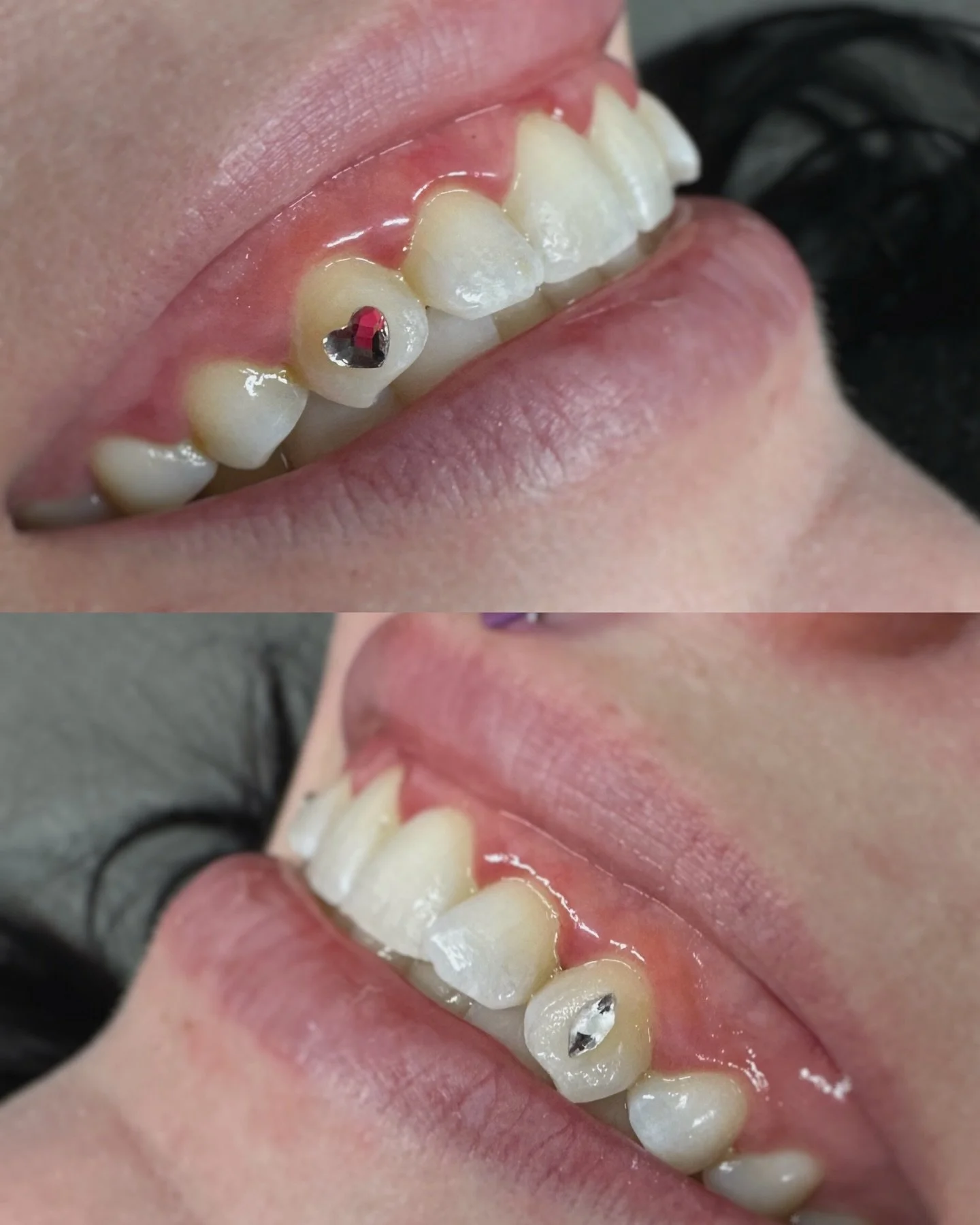 Cutie canines for my giveaway winner @_unevraiemess_

Merci Joanie! 💕

Tooth gems, bijoux dentaires, strass dentaire, Swarovski, montreal