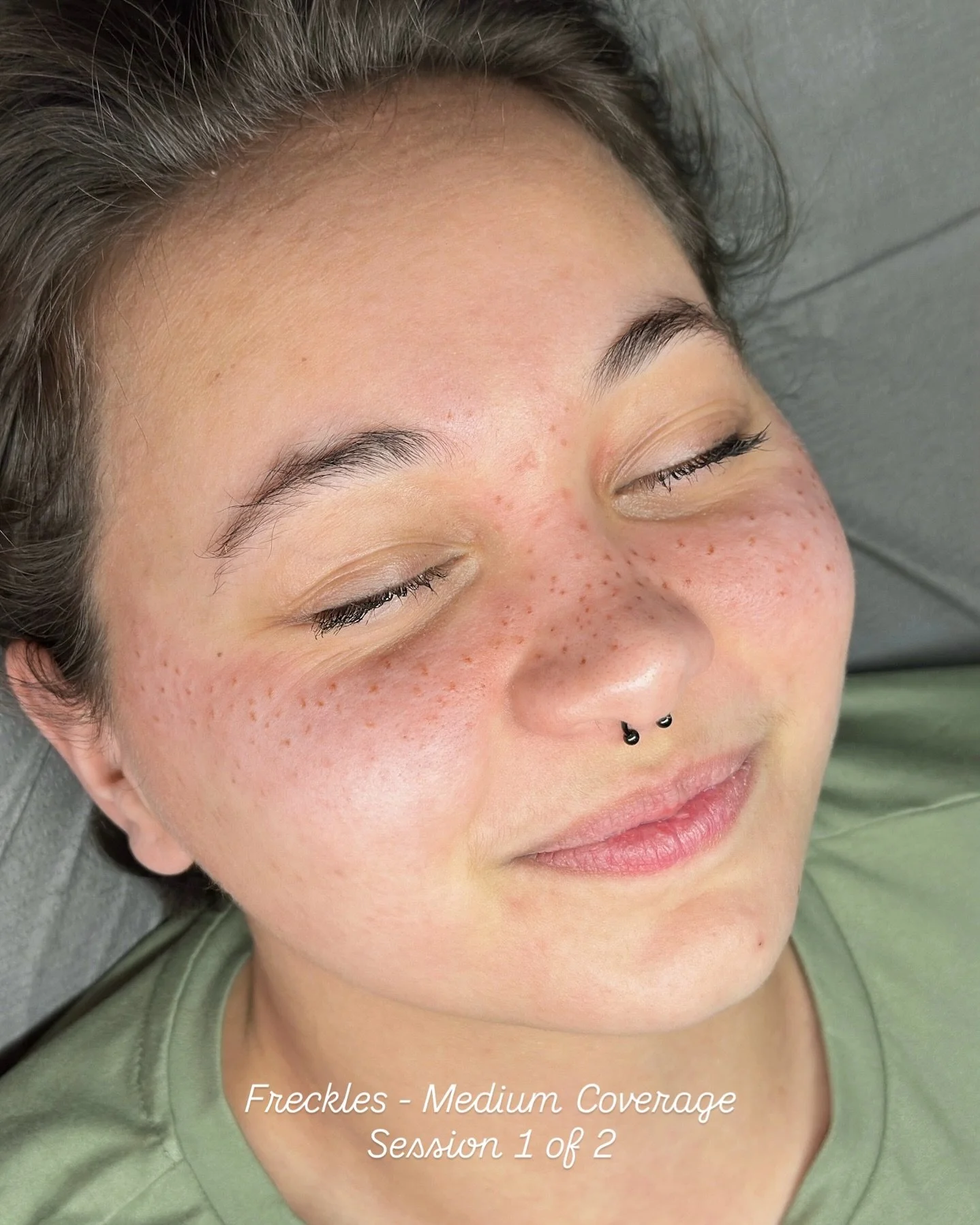 Freckles Tattoo - Medium Coverage Session 1 of 2
Freckles will fade 30%-40% upon healing

My lovely client Mia drove an hour in a snowstorm for her appointment 🥺

Freckles are forever my favourite service!! 

Using @mara.colors hazelnut 💖

Freckles