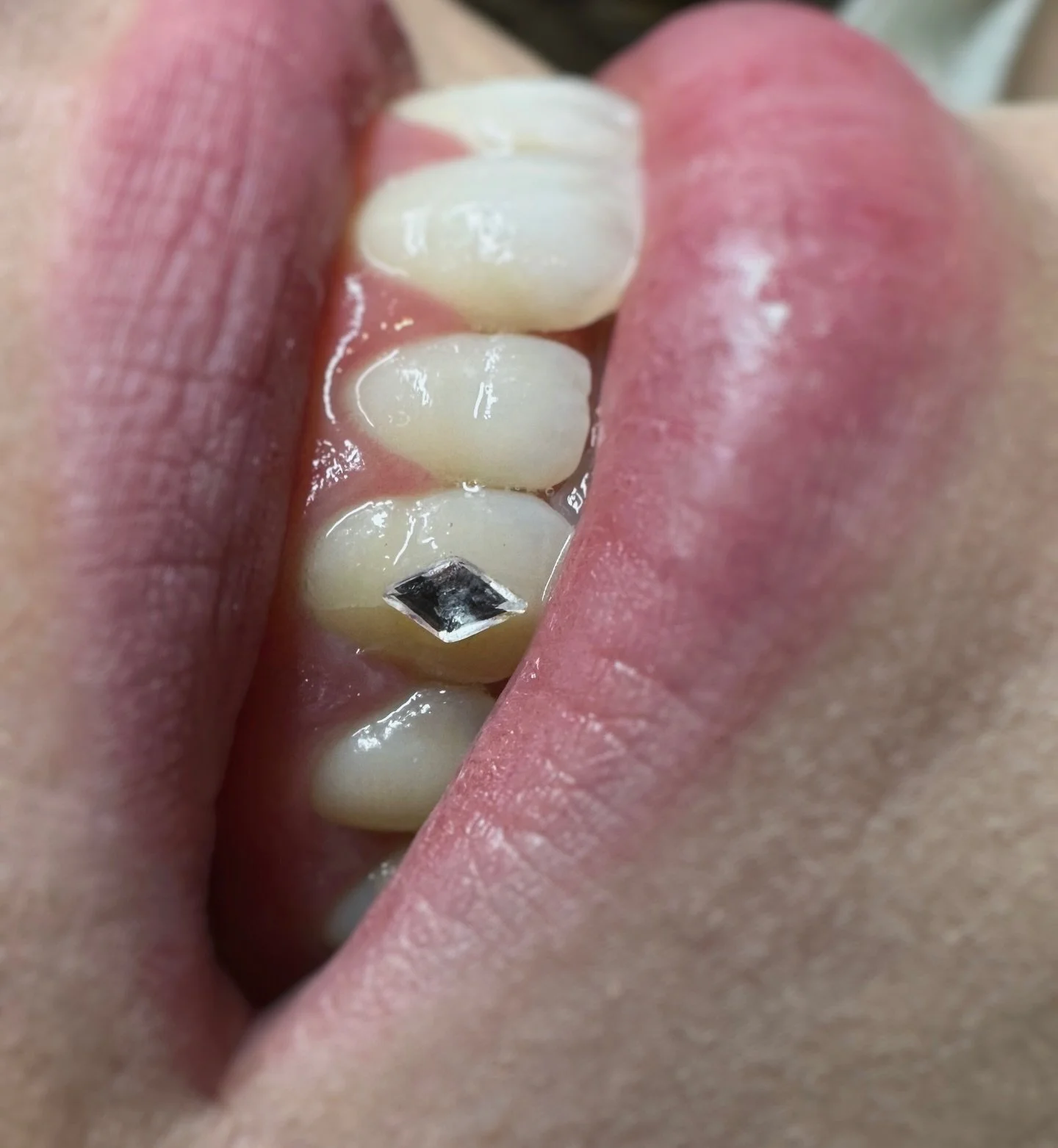 Classic diamond tooth gem canine on @marie____ange and a matching one for her friend Alicia that I didn&rsquo;t get a picture of

More matching friend gems please, this was so cute and fun!! 💖

Diamonds were by far my most popular shape this year 💎