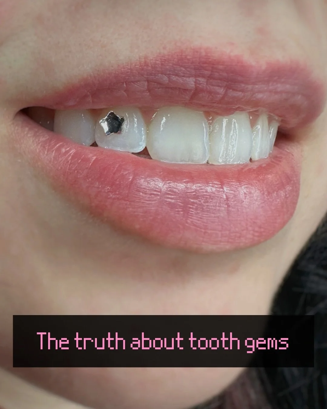 These are the questions I get asked the most about tooth gems. Did I forget anything? Leave it down below or DM me :)

Book yours today at the link on my profile! 

#toothgems #bijouxdentaires #montreal 

Tooth gems, Swarovski, preciosa, crystals, bi