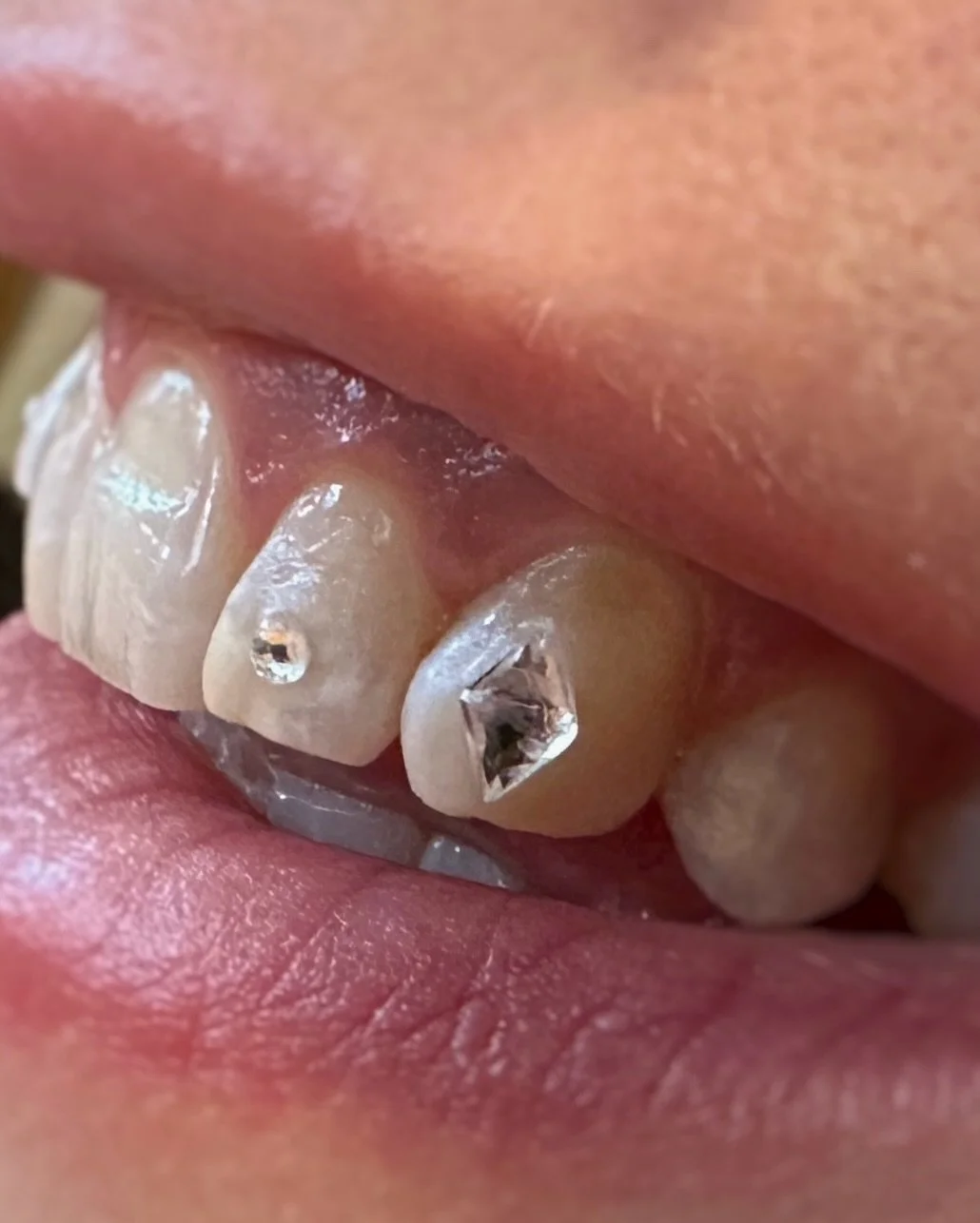 Diamond canines and gem incisors for @marie.philippe.plante 💠💠

Done at @le.116.tattooclub during my guest spot