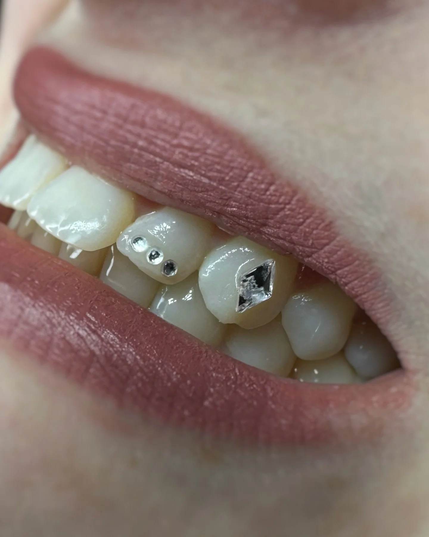 Loved this unique idea!! Bring me your fun tooth gem designs 💕

Done at @mtlpunkrockfleamarket