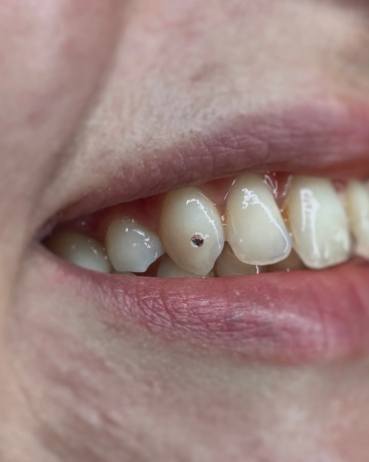 Single front-facing gem done at @mtlpunkrockfleamarket 

Tooth gems, Montreal, bijoux dentaires, swarovski
