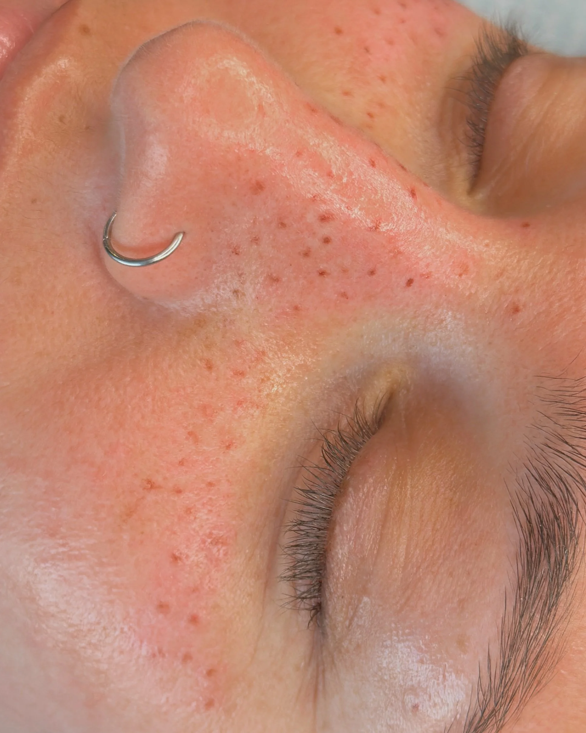 freckle tattoos, taches de rousseur, maquillage permanent