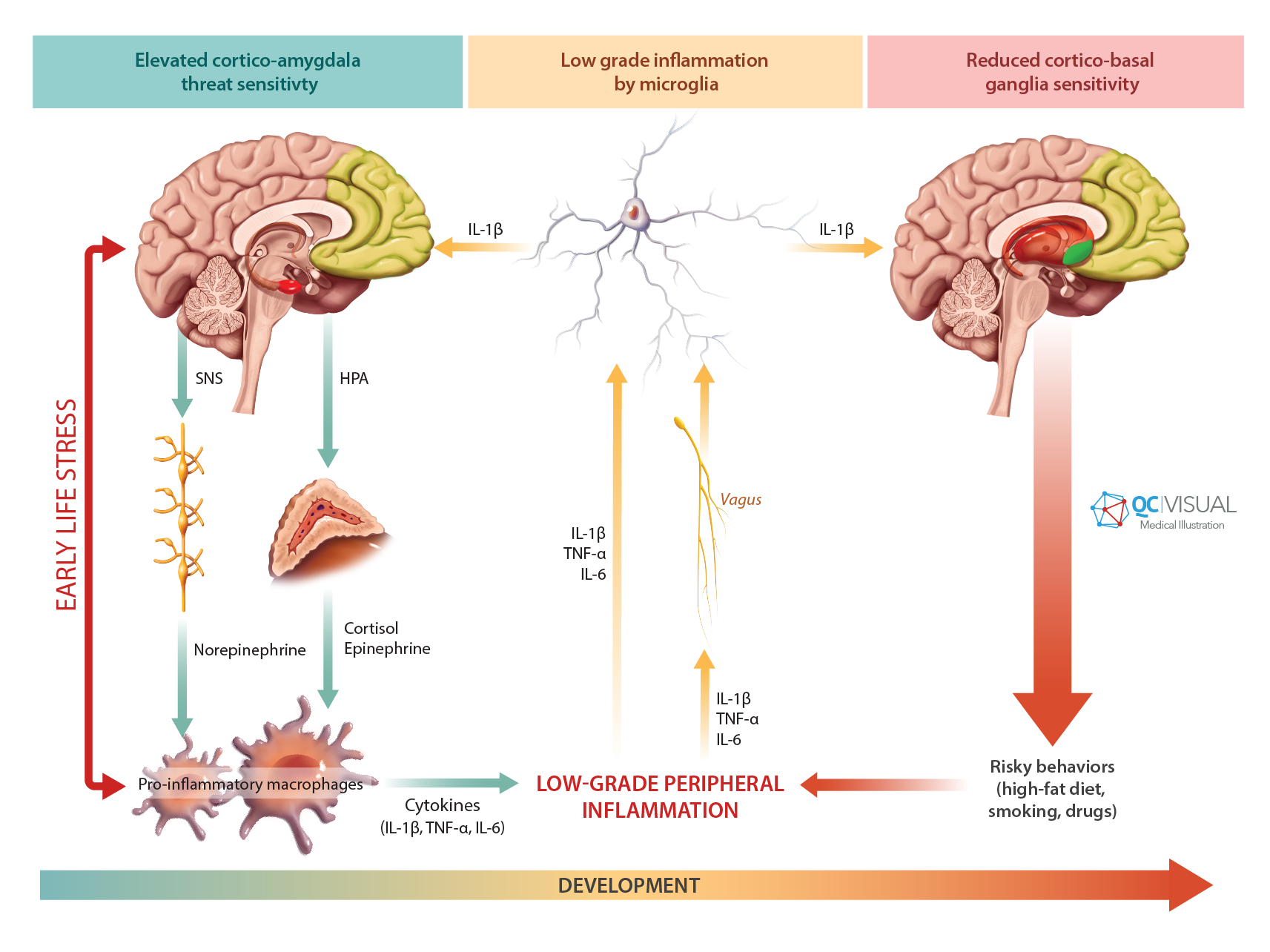 Diagram showing brain pathways involved in early life stress, peripheral inflammation, and risk behaviors. The illustration highlights elevated cortico-amygdala threat sensitivity, low-grade inflammation by microglia, and reduced cortico-basale gangl