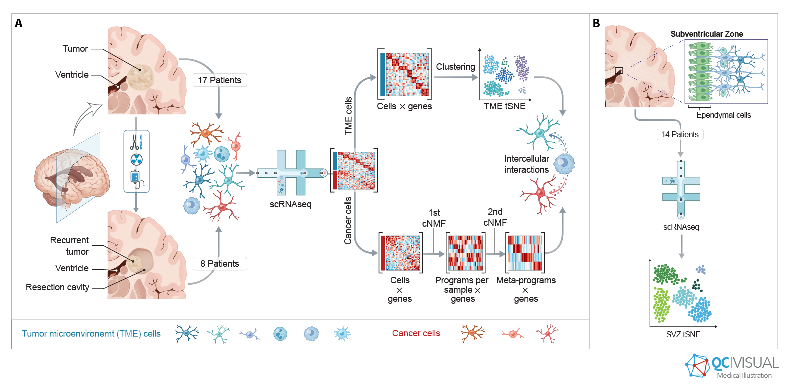 Diagram showing analysis of tumor microenvironment and cancer cells from brain tissue samples of patients with recurrent and non-recurrent tumors. It includes steps of tissue dissection, cell separation, scRNA-seq, and analysis of cell interactions a