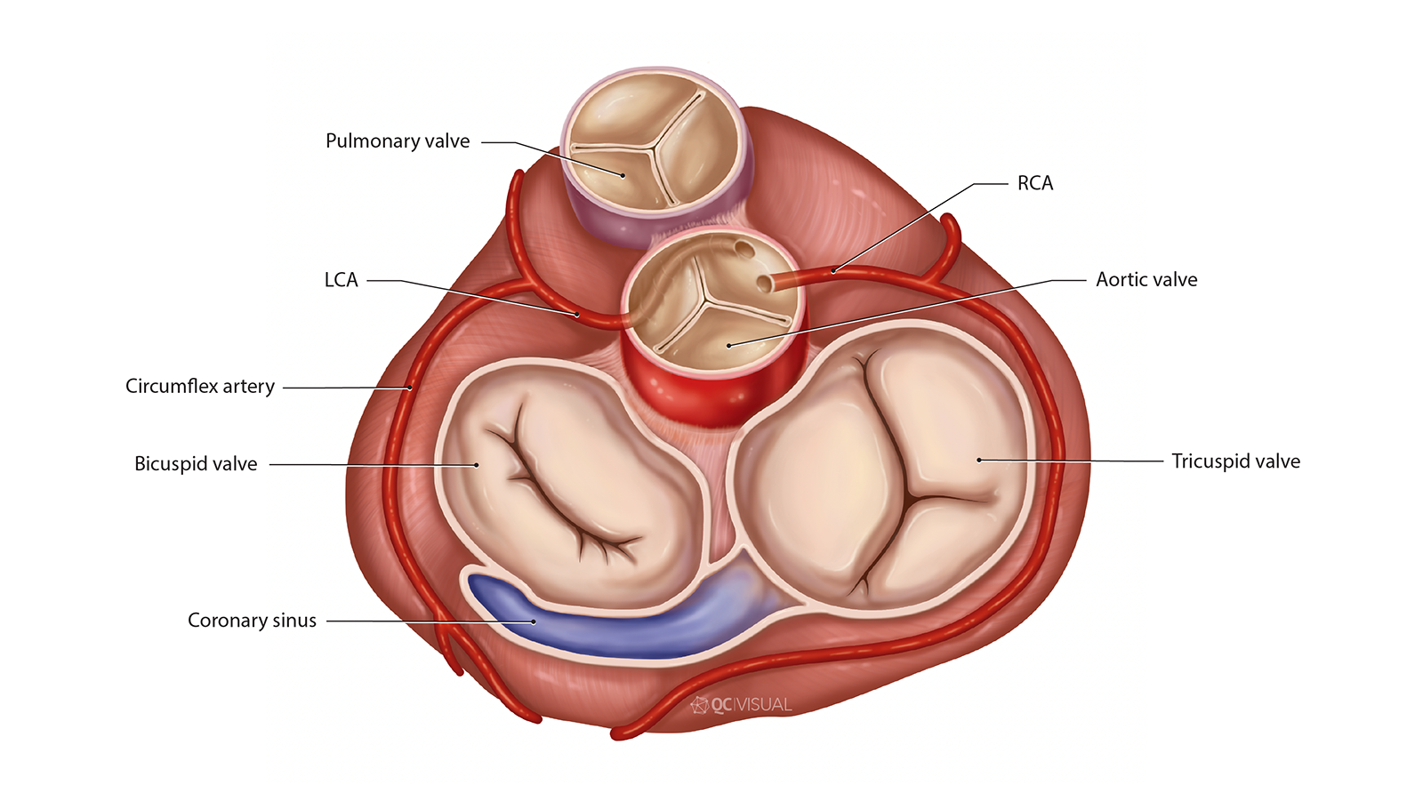 Diagram of the heart showing labeled parts including pulmonary valve, aortic valve, RCA, LCA, circumflex artery, bicuspid valve, tricuspid valve, and coronary sinus.