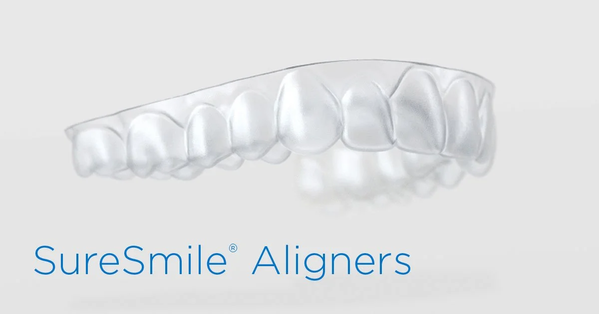 SureSmile® clear top teeth aligner