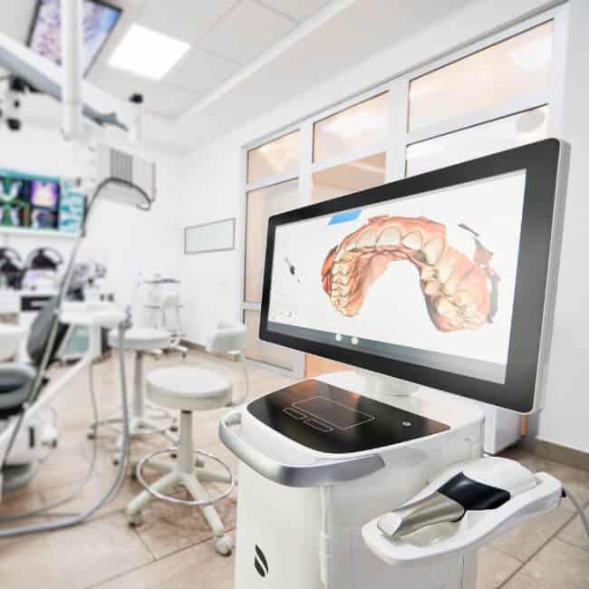 Screen in a dental exam room showing dental impressions of teeth.