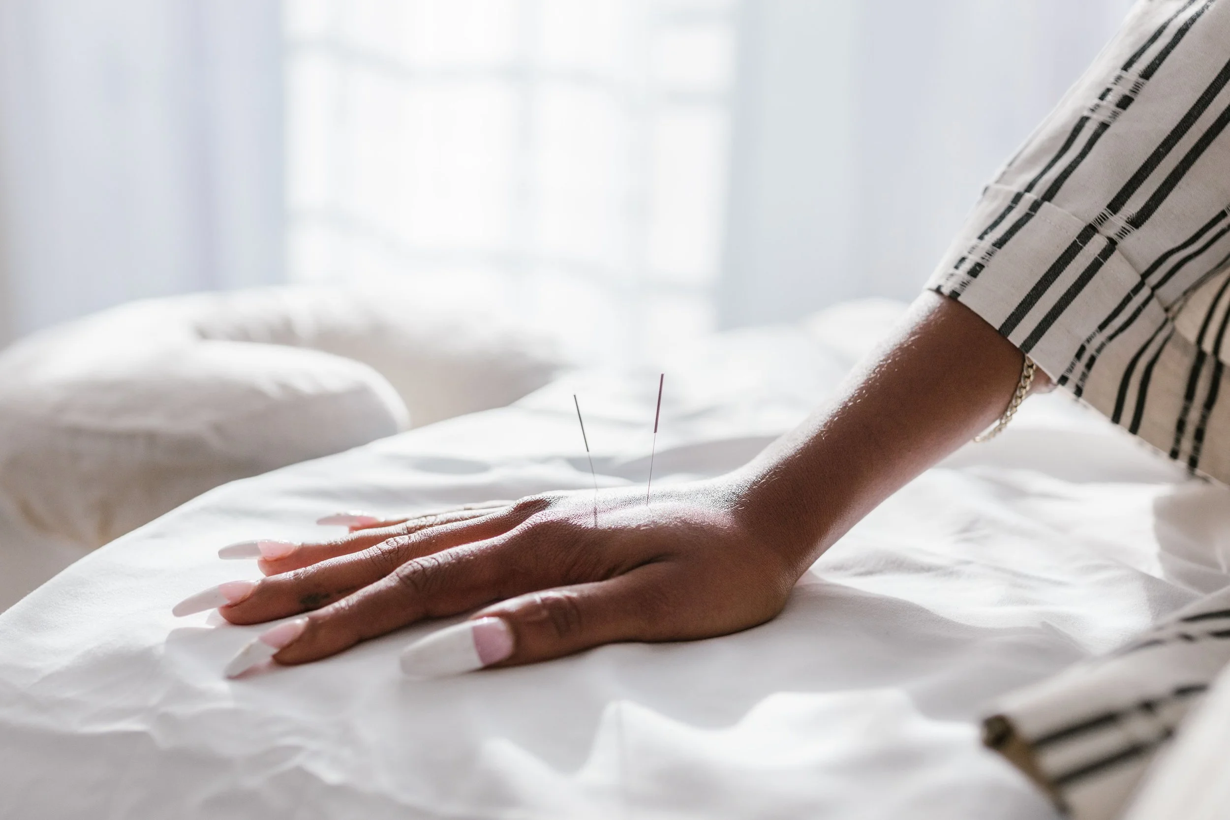 Acupuncture vs. Functional Medicine: What's the Difference?