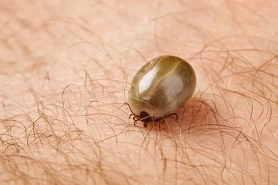 How to Get Rid of Ticks