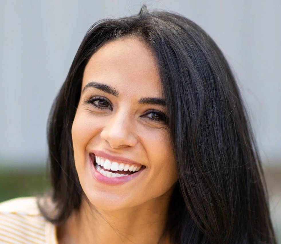 Young woman smiling after cosmetic dentistry at Accent Your Dentist in Ponsonby, Auckland, achieving a brighter, natural-looking smile.