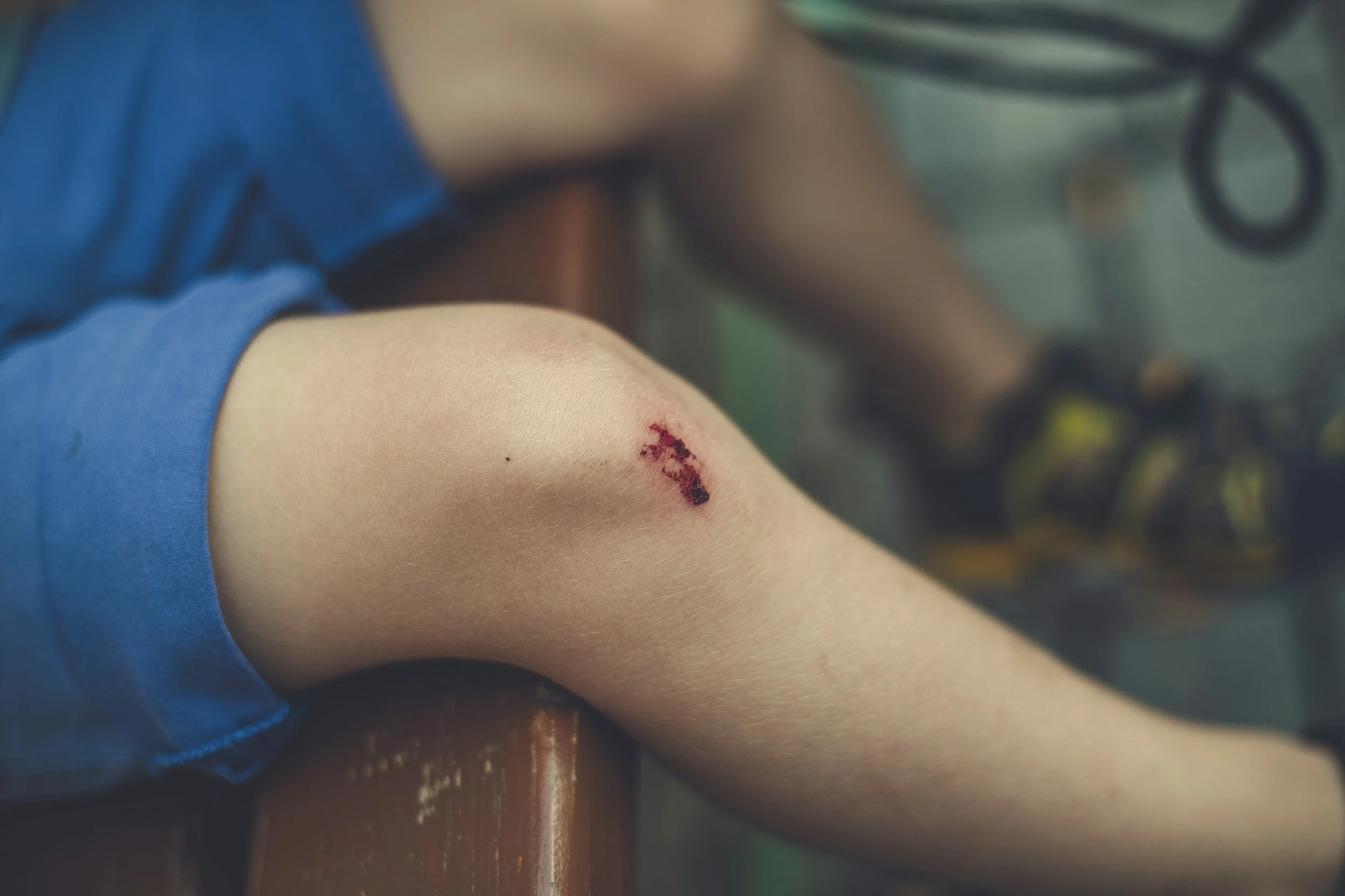 En persons arm med en liten blodig ripe eller utvekst.