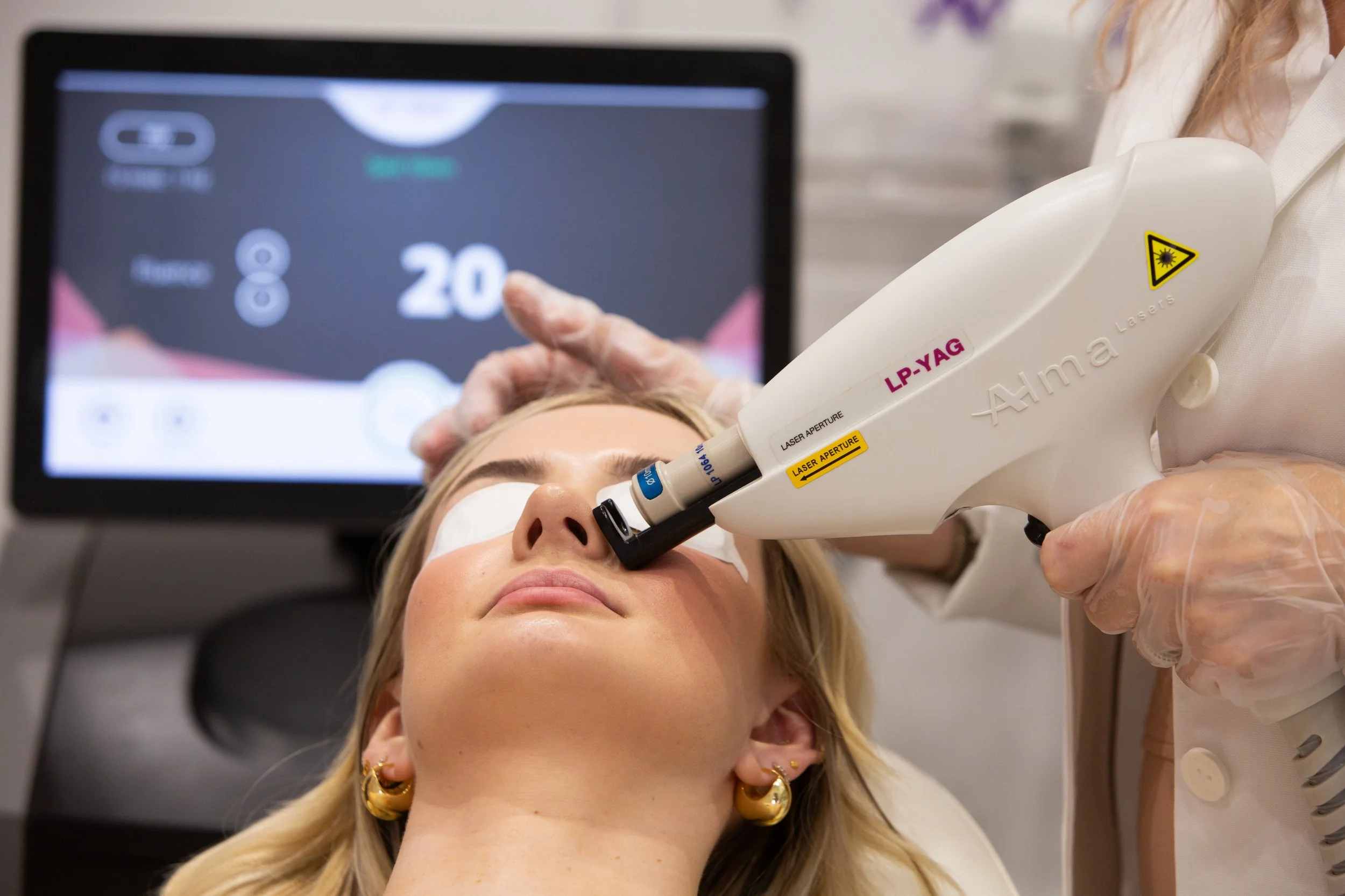 A woman receiving laser skin treatment on her face in a medical clinic, with a laser device directed at her nose and eyes covered with eye shields.