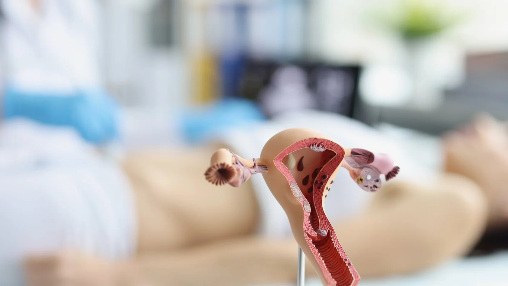 New Technologies Could Help Cut the Years-Long Wait for an Endometriosis Diagnosis