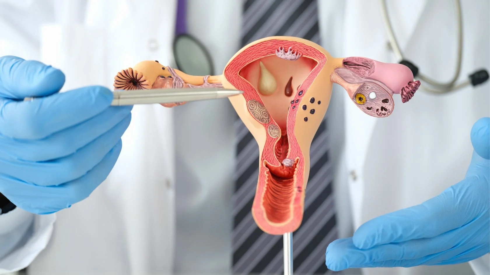 Hysteroscopy: Is It Painful, Is It Safe, and What to Expect