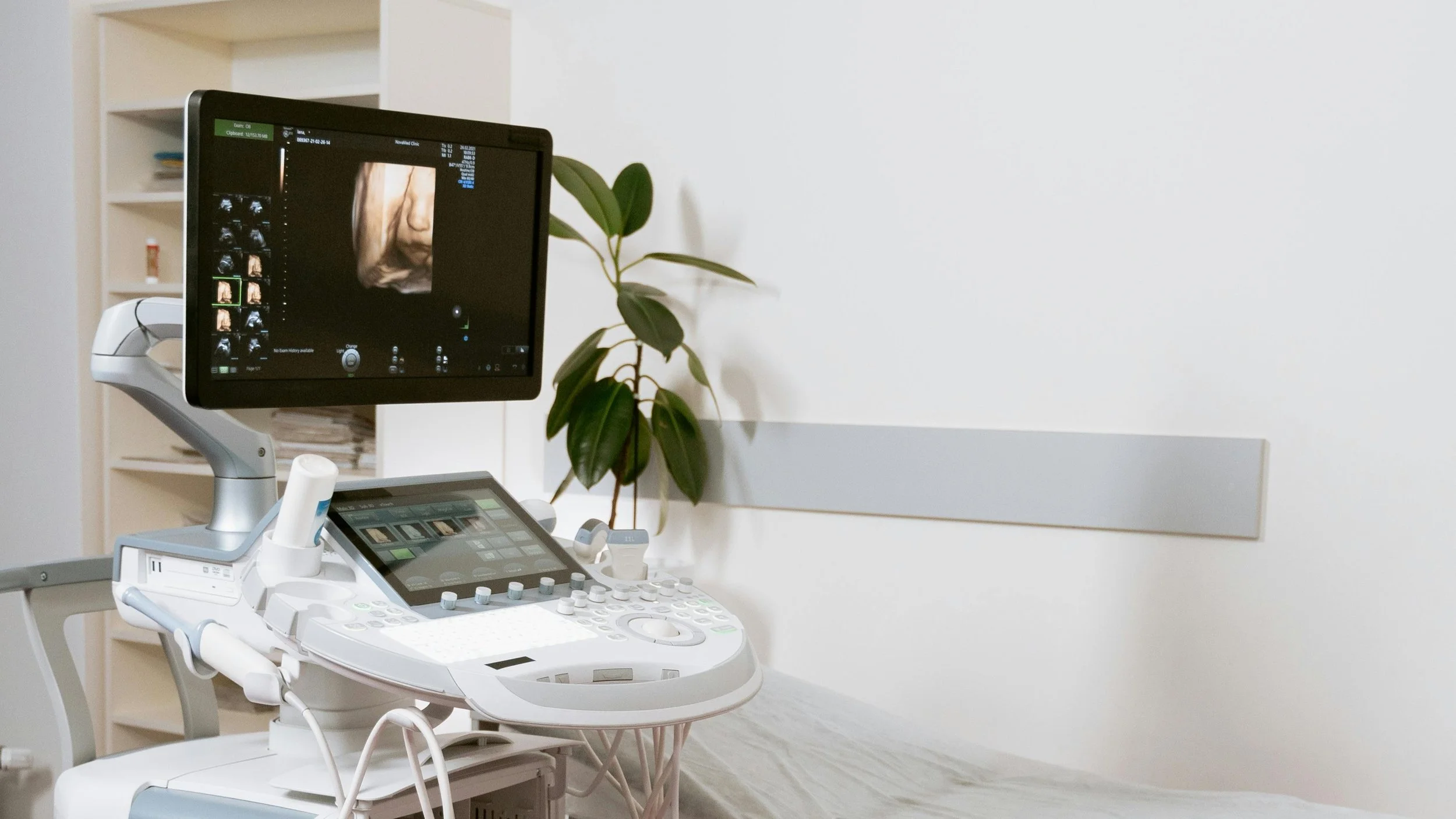 Ultrasound machine in a clinical scanning room used for pregnancy and gynaecological diagnostic imaging