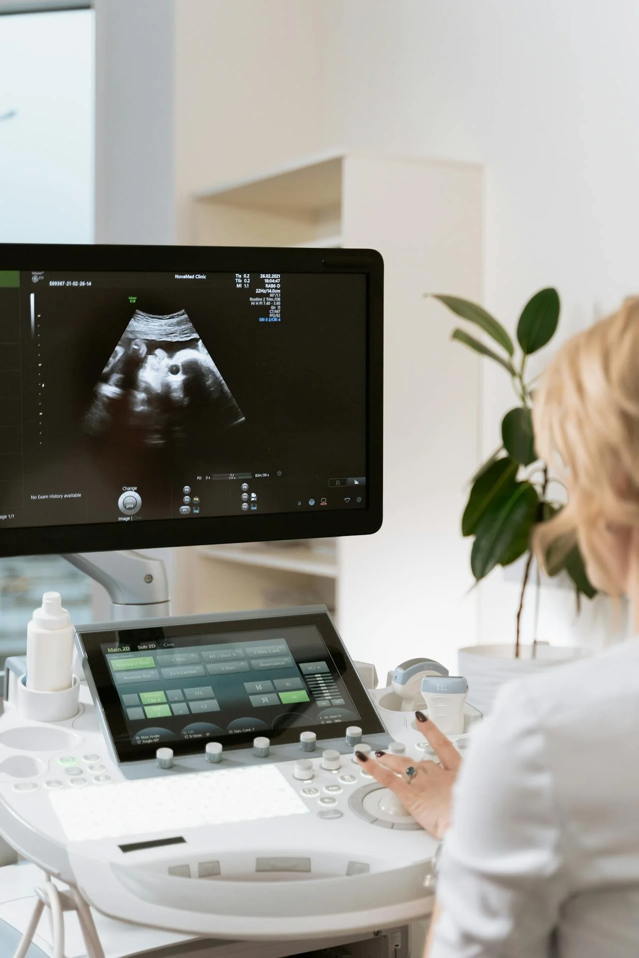 Woman viewing an early pregnancy ultrasound scan during a gynaecology consultation