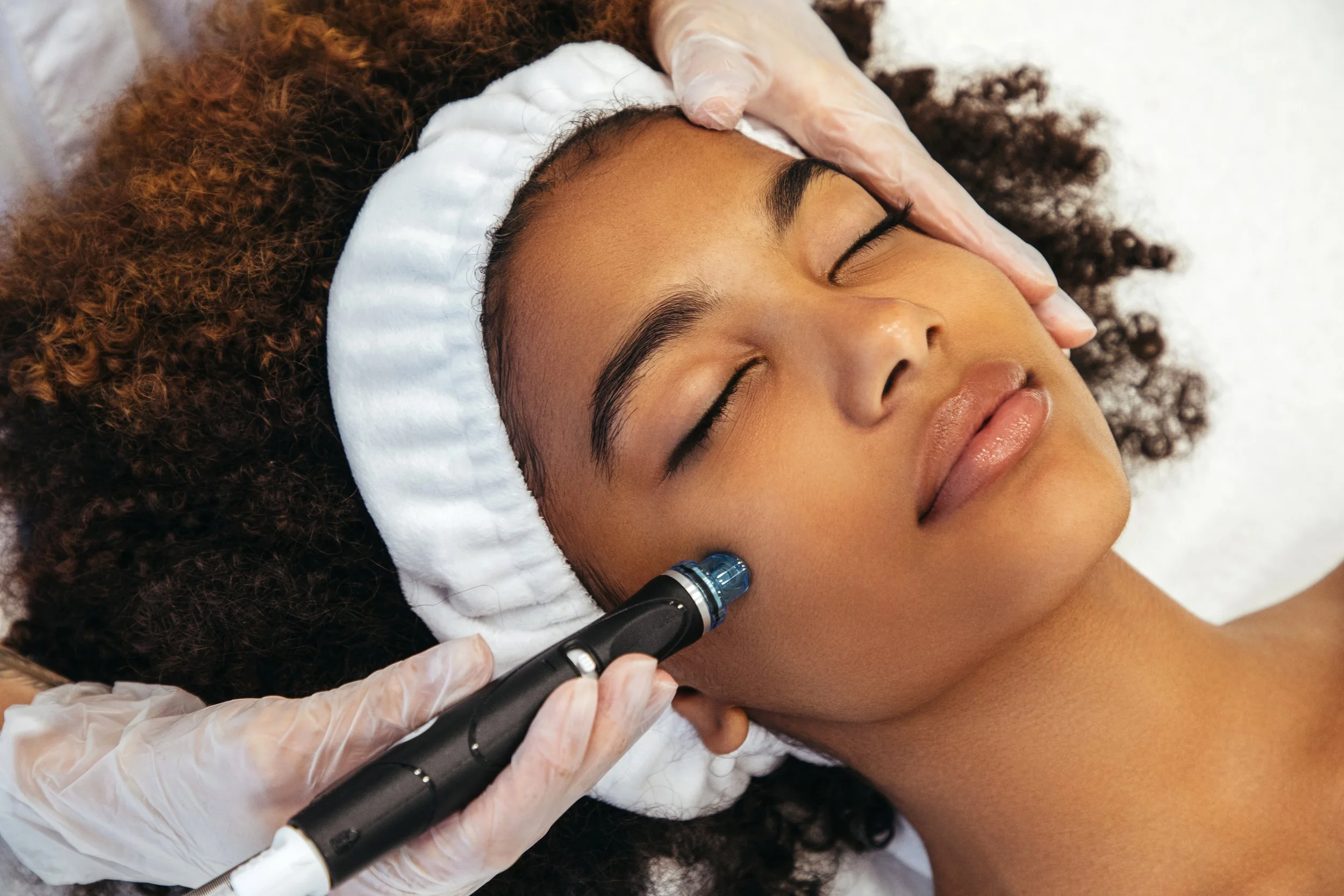 Medspa in Gilbert, AZ, 85234  Microneedling Near Me