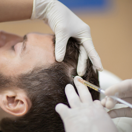 A person receiving a medical injection in the scalp from a healthcare professional wearing gloves.
