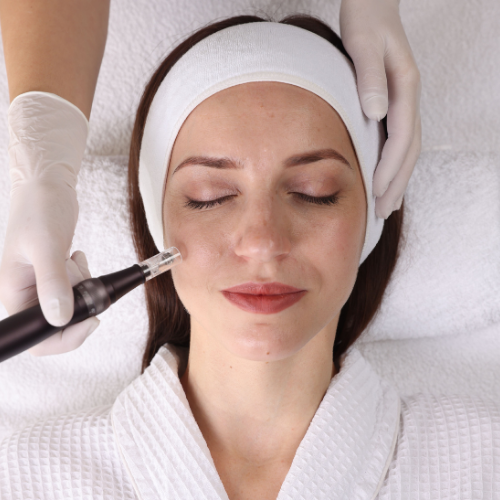 A woman receiving a facial treatment with a derma pen in a spa or clinic setting.