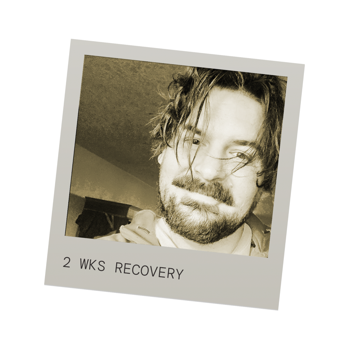 Sepia toned photo of a man with curly hair and beard, smiling slightly, with text '2 WKS RECOVERY' at the bottom.