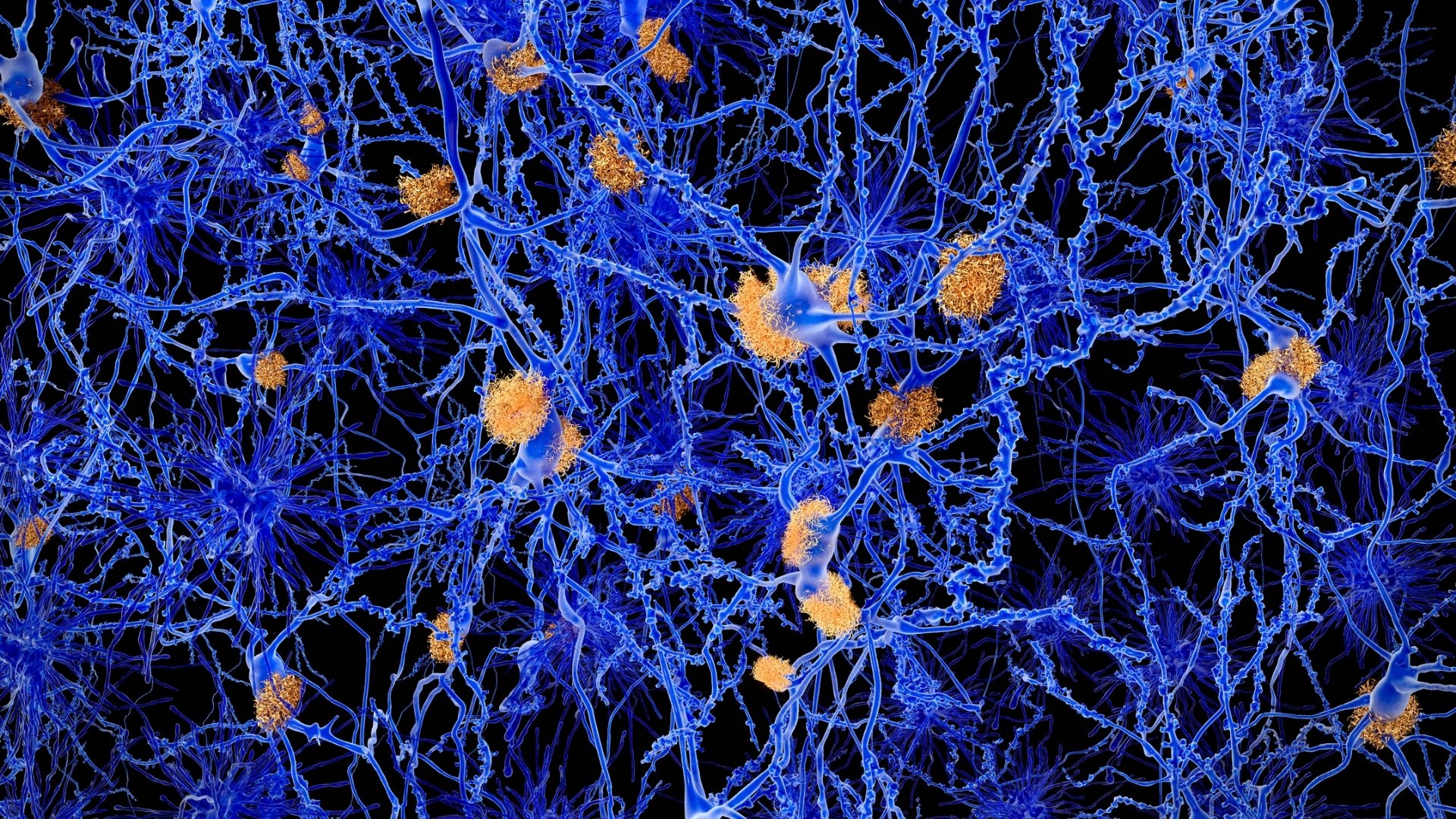 Was ist Neuronale Plastizität?