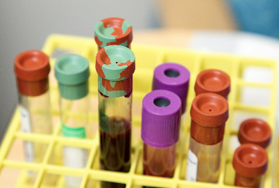 I need another test!?