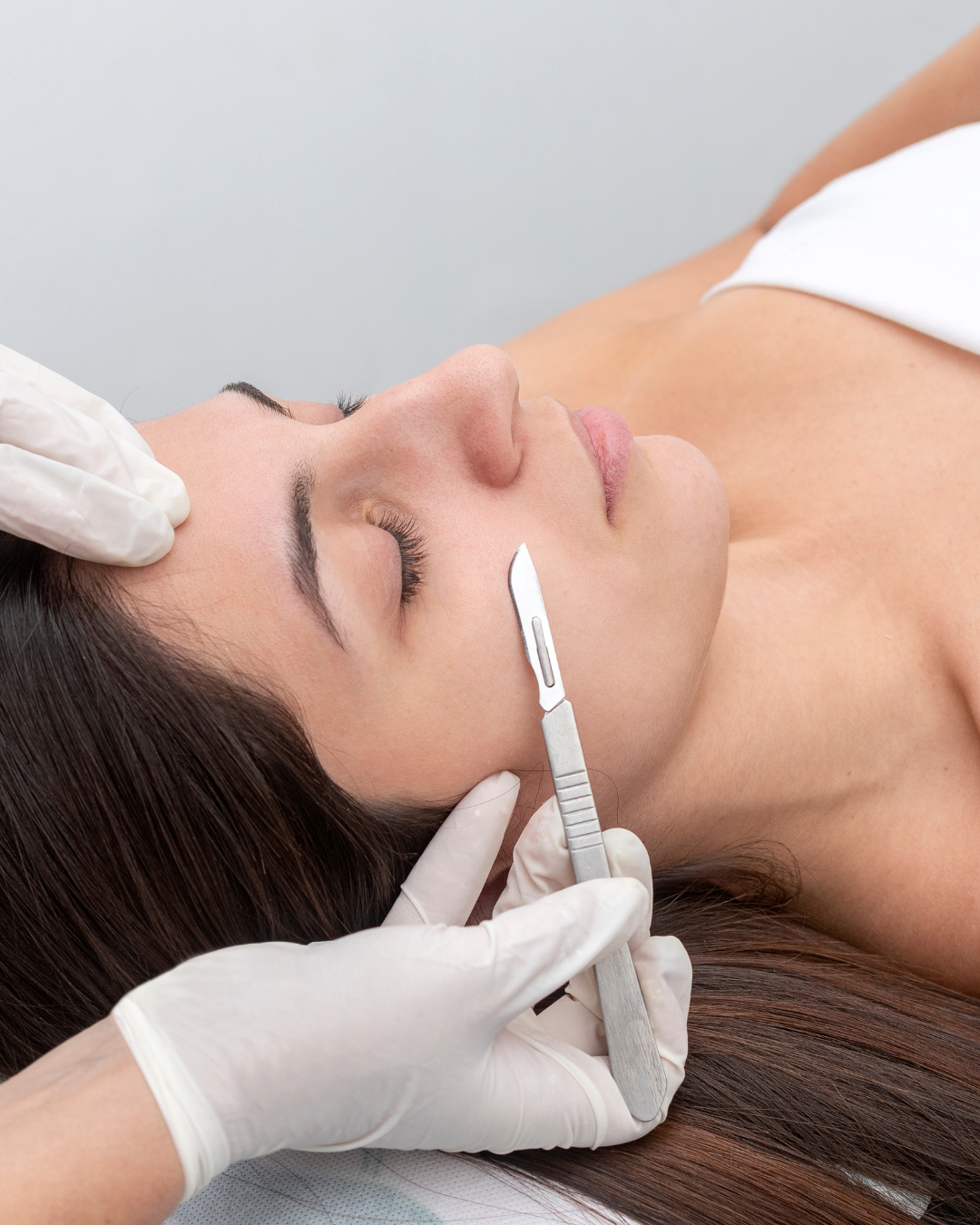 Medspa in Creve Coeur, MO, 63141  Dermaplaning Near Me.png