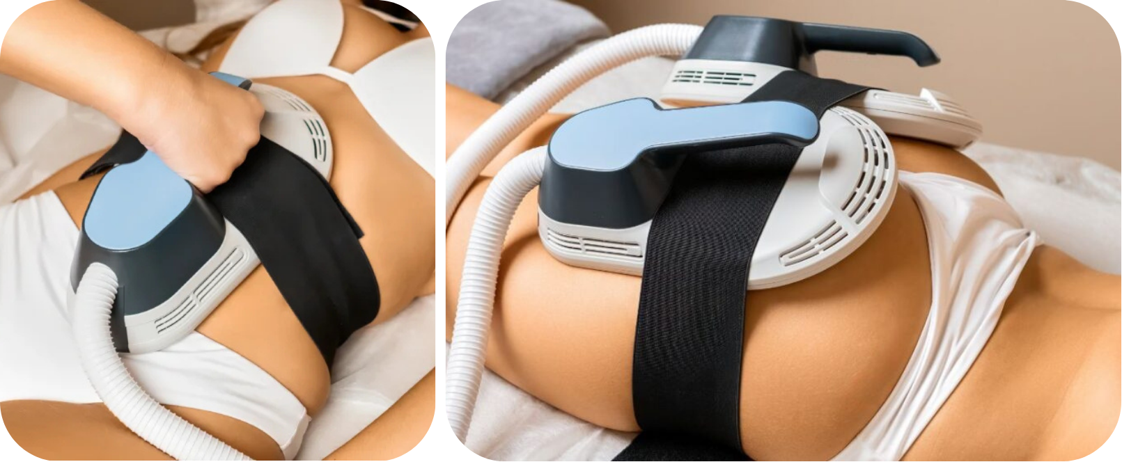 Person undergoing a medical procedure with a machine on their abdomen, using handles and a hose connected to the device, lying on a bed in underwear.