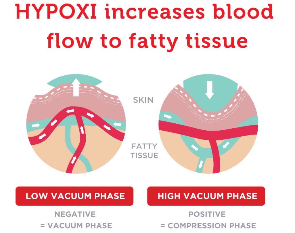 Comparison of low vacuum and high vacuum skin treatments showing pore size reduction and skin tightening.