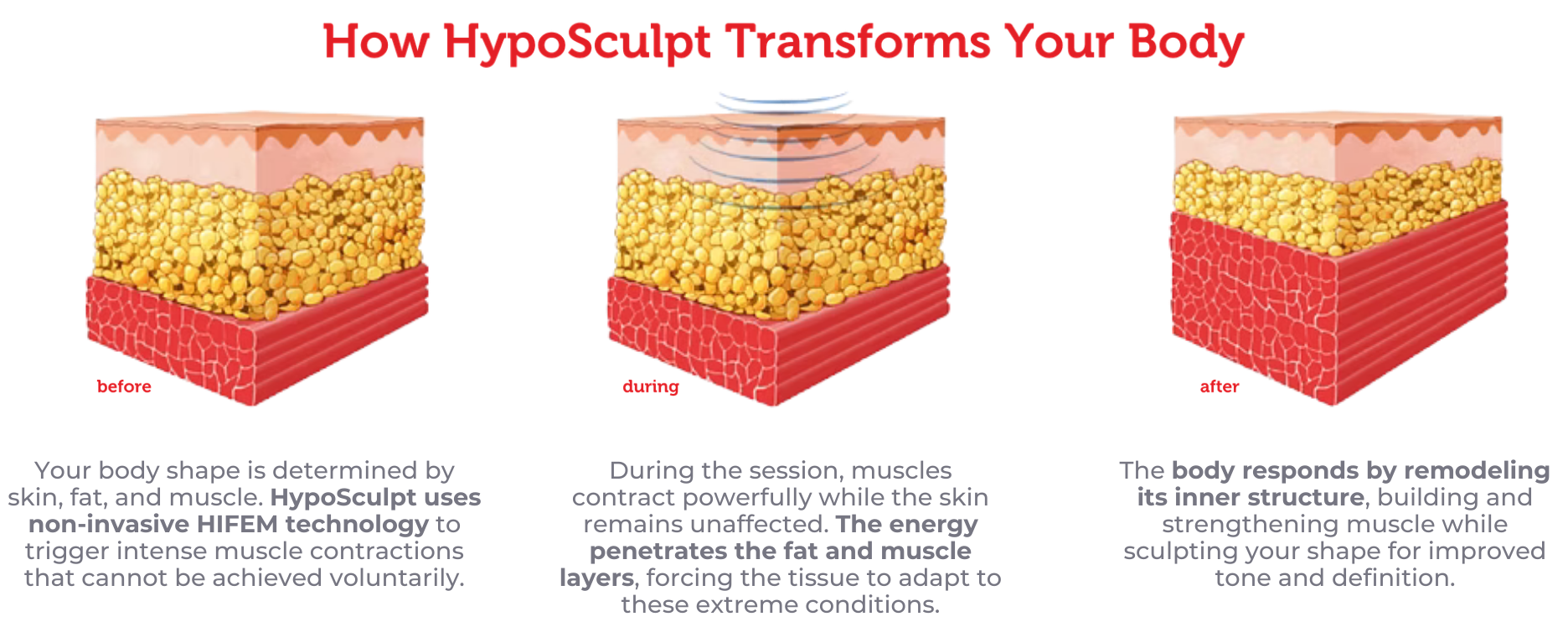 Diagram showing how hyaluronic acid transforms the body. The left side shows the before state with a layer of fat and skin underneath. The middle shows ultrasound waves penetrating the skin. The right side shows the after state with increased muscle and reduced fat, with improved skin elasticity.