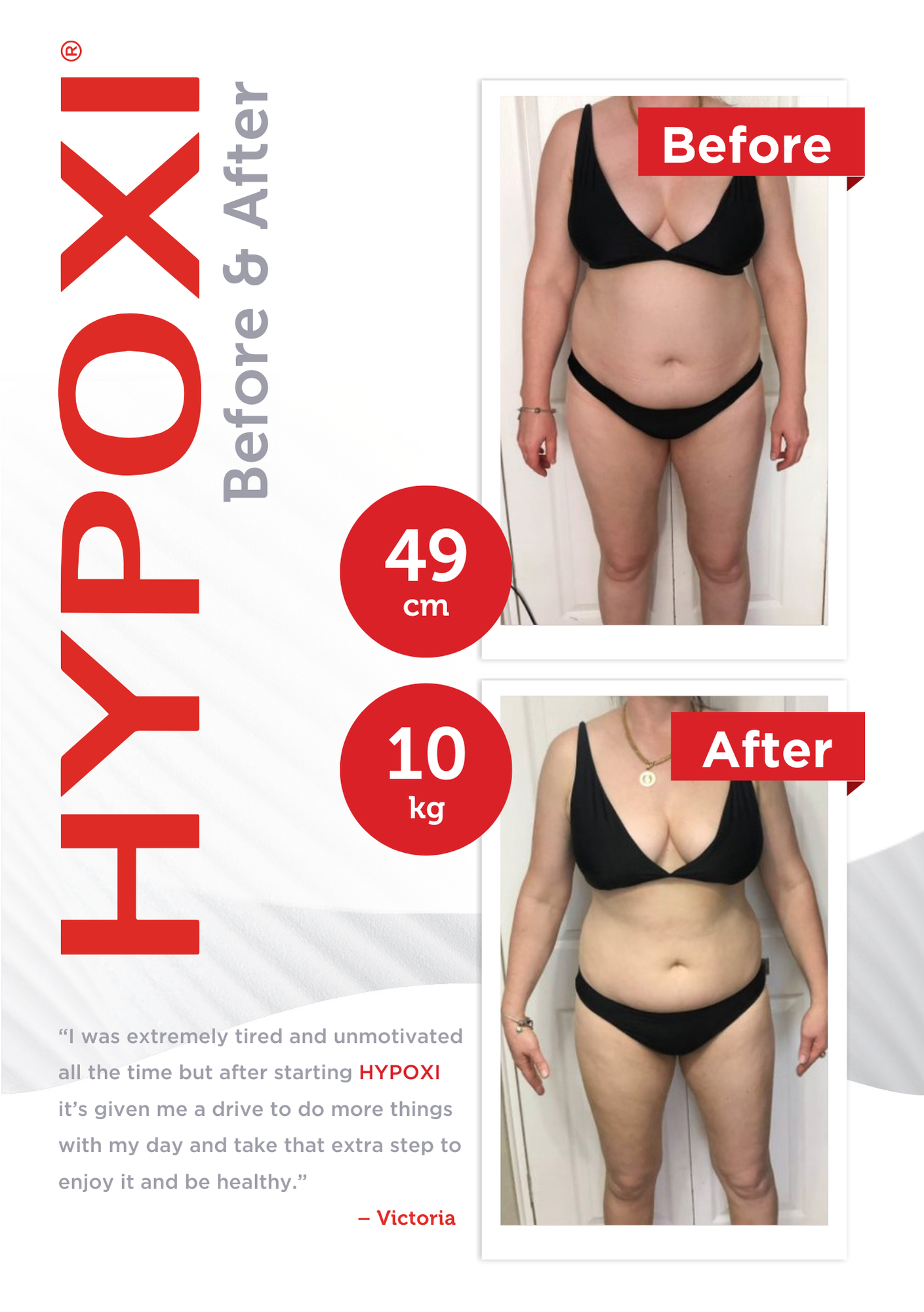 A before and after weight loss transformation showing a woman in a black bikini. The 'Before' photo depicts her with a waist measurement of 49 cm and a weight of 10 kg lost. The 'After' photo shows her with a slimmer waist and overall lighter physique. The text highlights her positive experience with Hypoxi treatment.