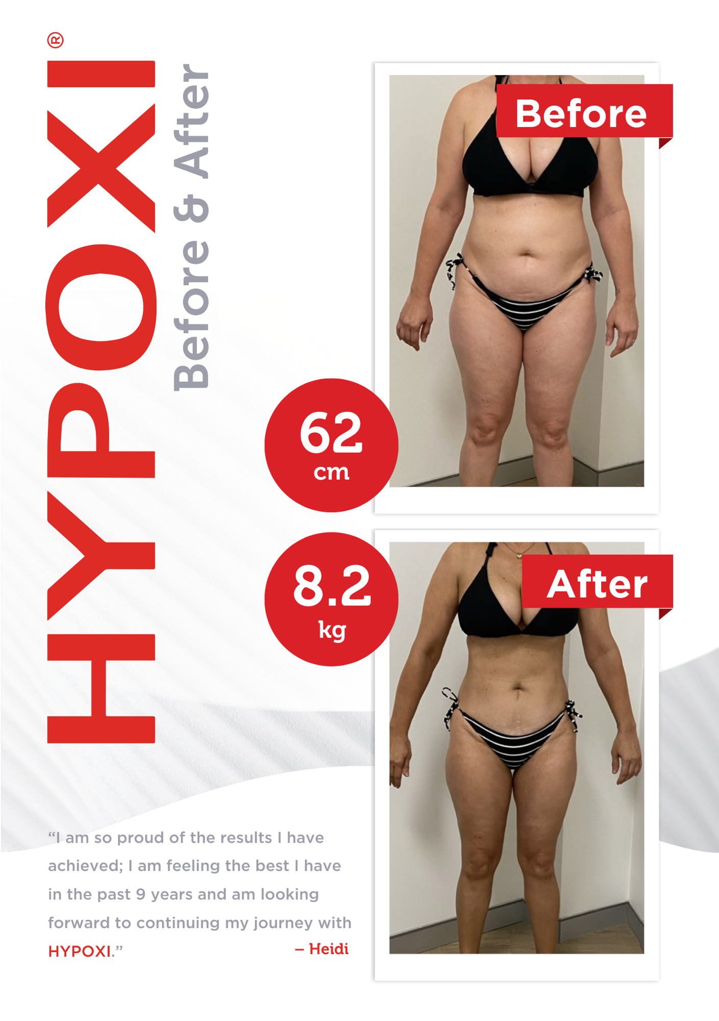 Before and after comparison photos of a woman who lost weight, showing her in a black bikini. The 'Before' image shows her with a larger body, while the 'After' image shows her slimmer. The text highlights a reduction of 62 centimeters in waist size and a loss of 8.2 kilograms. The advertisement promotes a product called Hypoxi, with a quote from Heidi expressing pride in her results.