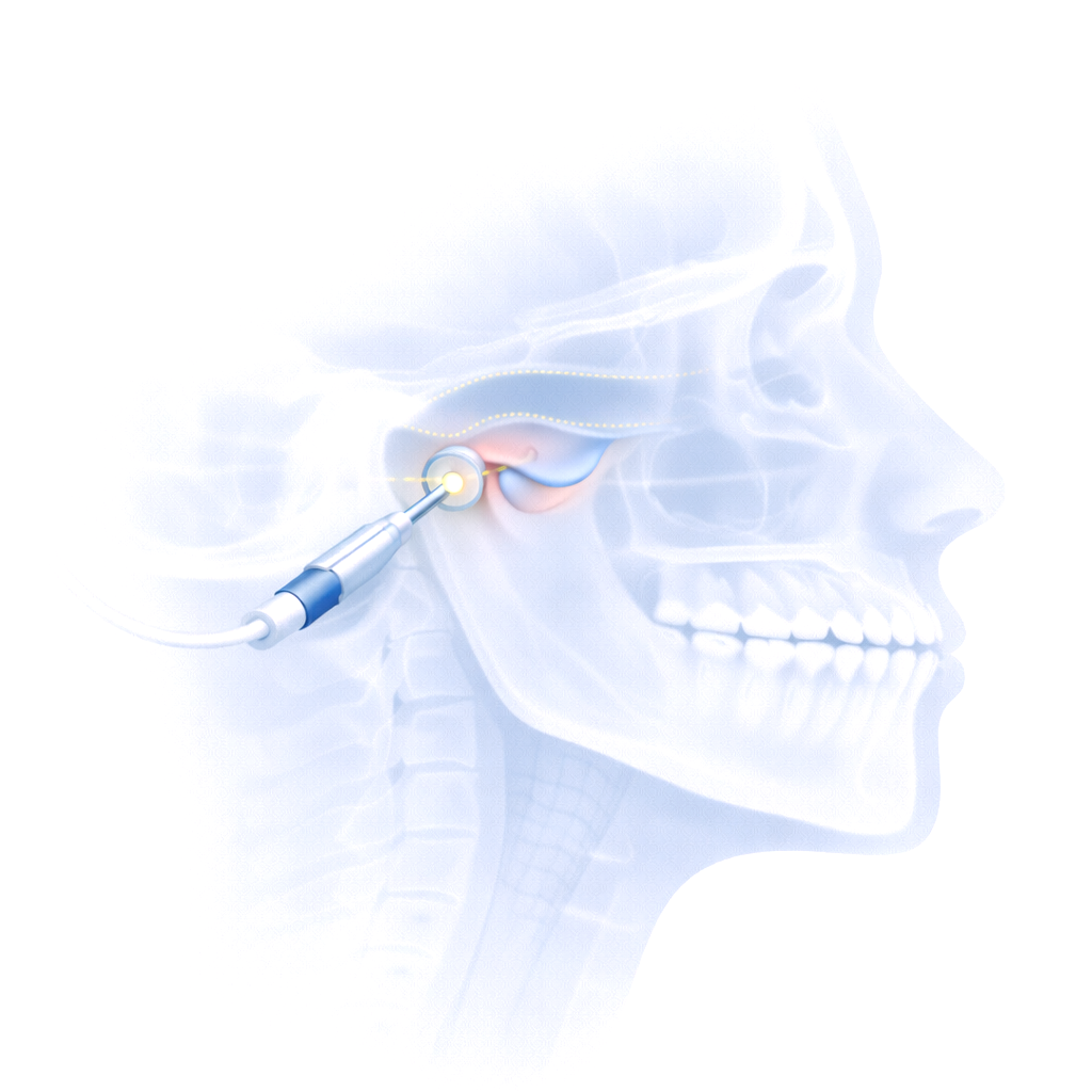 Articulación Temporomandibular (ATM)