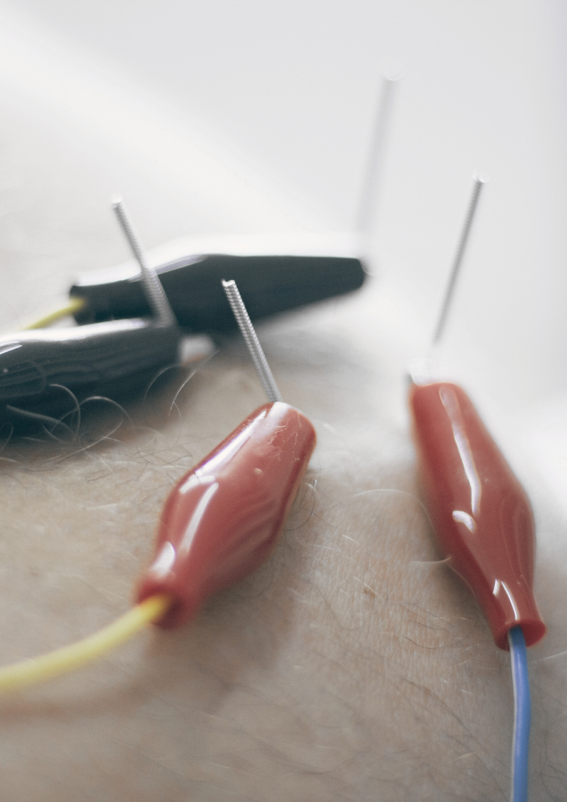 Paglia Rehab Dry Needling Concierge Mobile PT