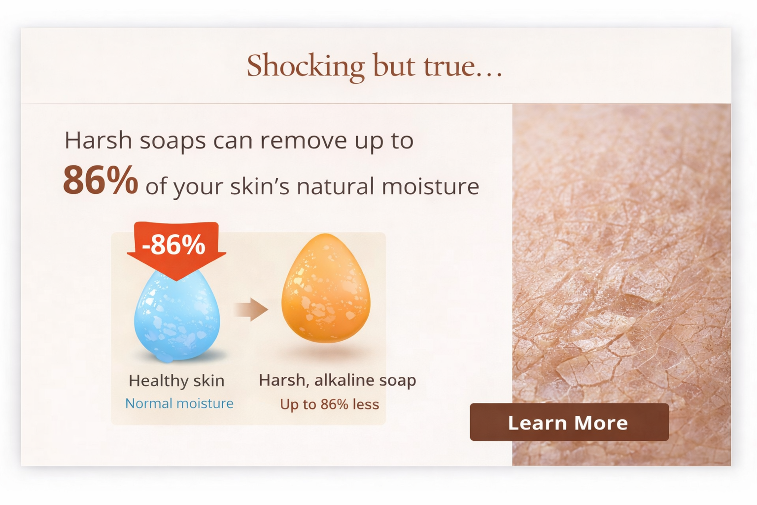 An infographic showing that harsh soaps can remove up to 86% of your skin's natural moisture compared to healthy skin. The image features a blue water droplet labeled 'Healthy skin' and an orange droplet labeled 'Harsh, alkaline soap,' with a red arrow indicating 86% less moisture. There is a close-up image of dry, cracked skin on the right side and a brown button with white text that says 'Learn More.'