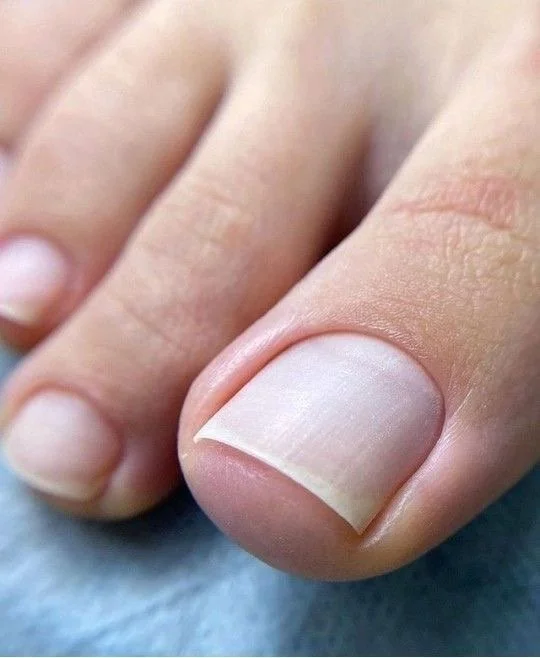 Pedicure