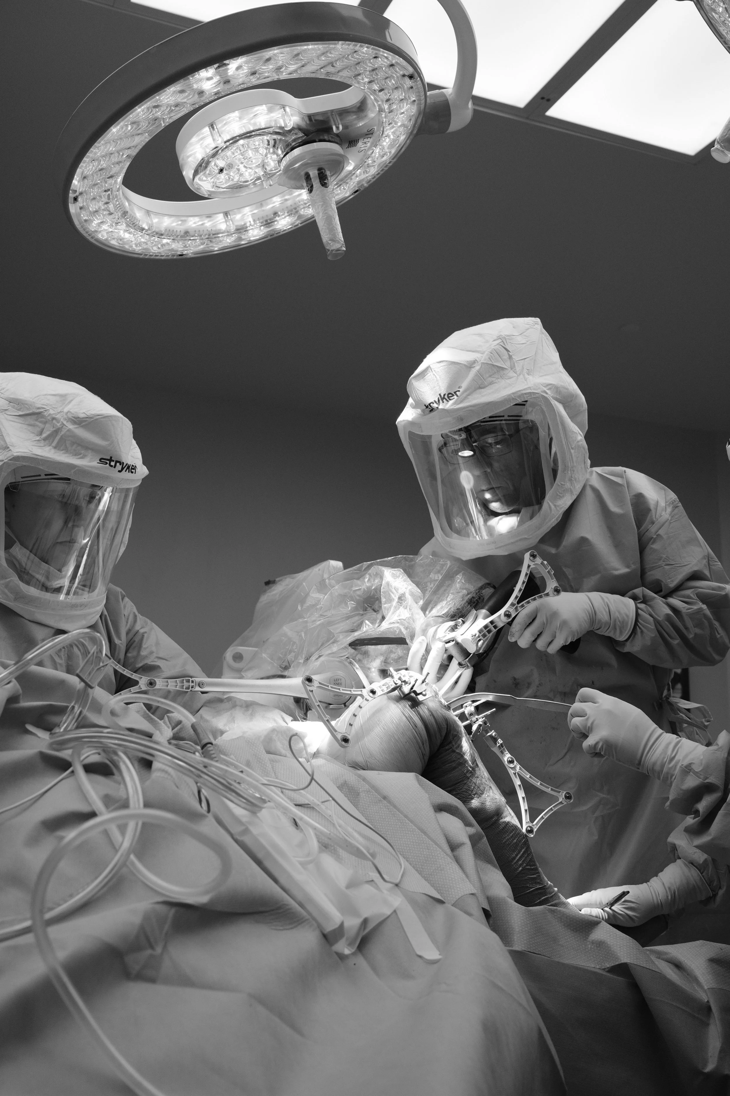 Does the Type of Robot Matter in Knee Replacement?