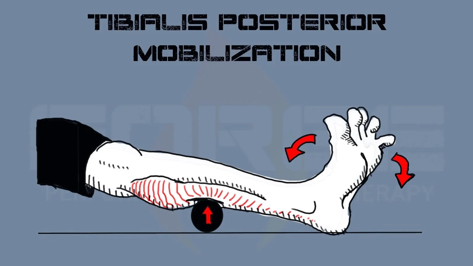 Plantar Fasciitis: Getting to the Root Cause